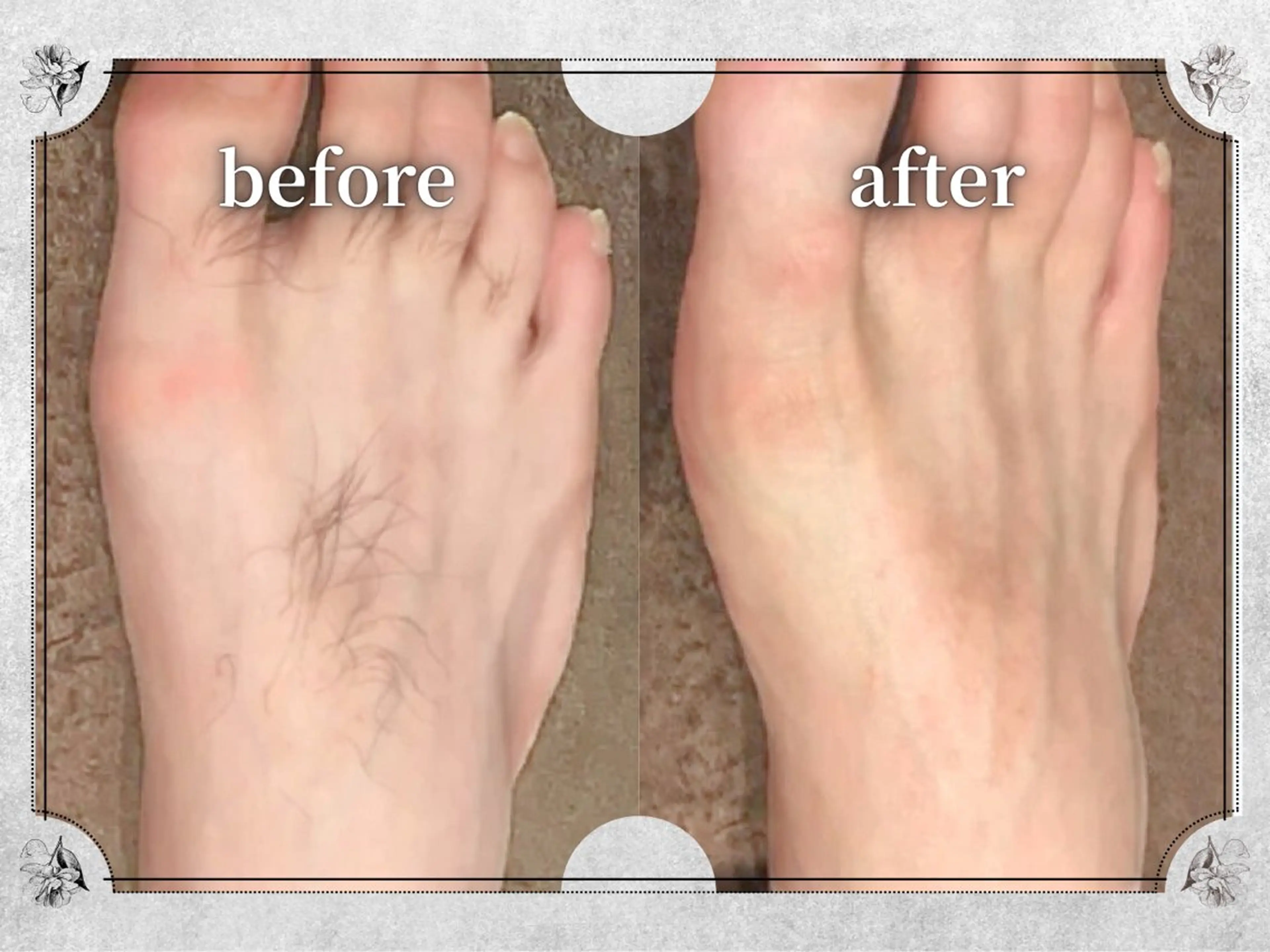 都度払い脱毛 Lino柏/Moneのエステ・リラクイメージ