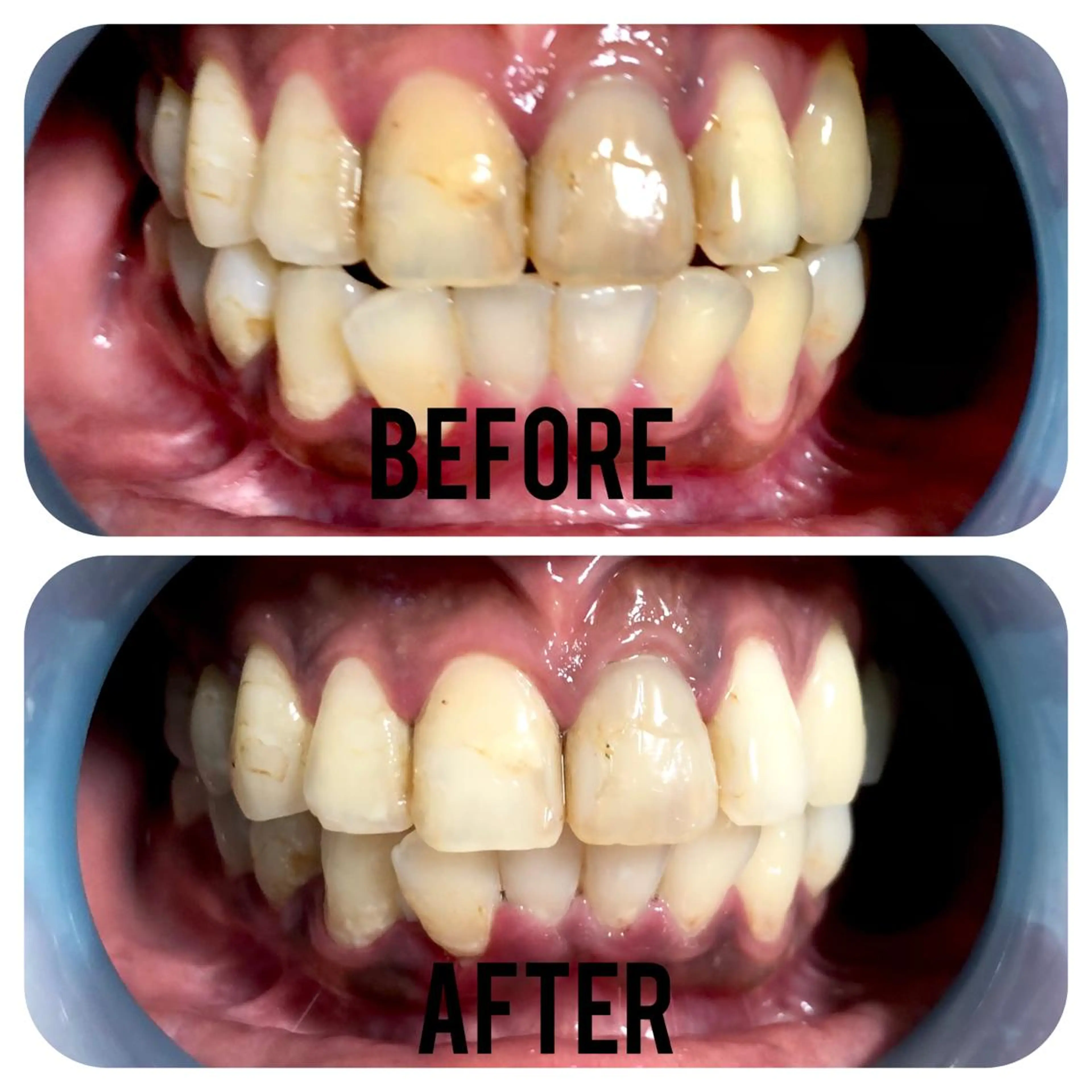 その他 two nailのネイルデザイン