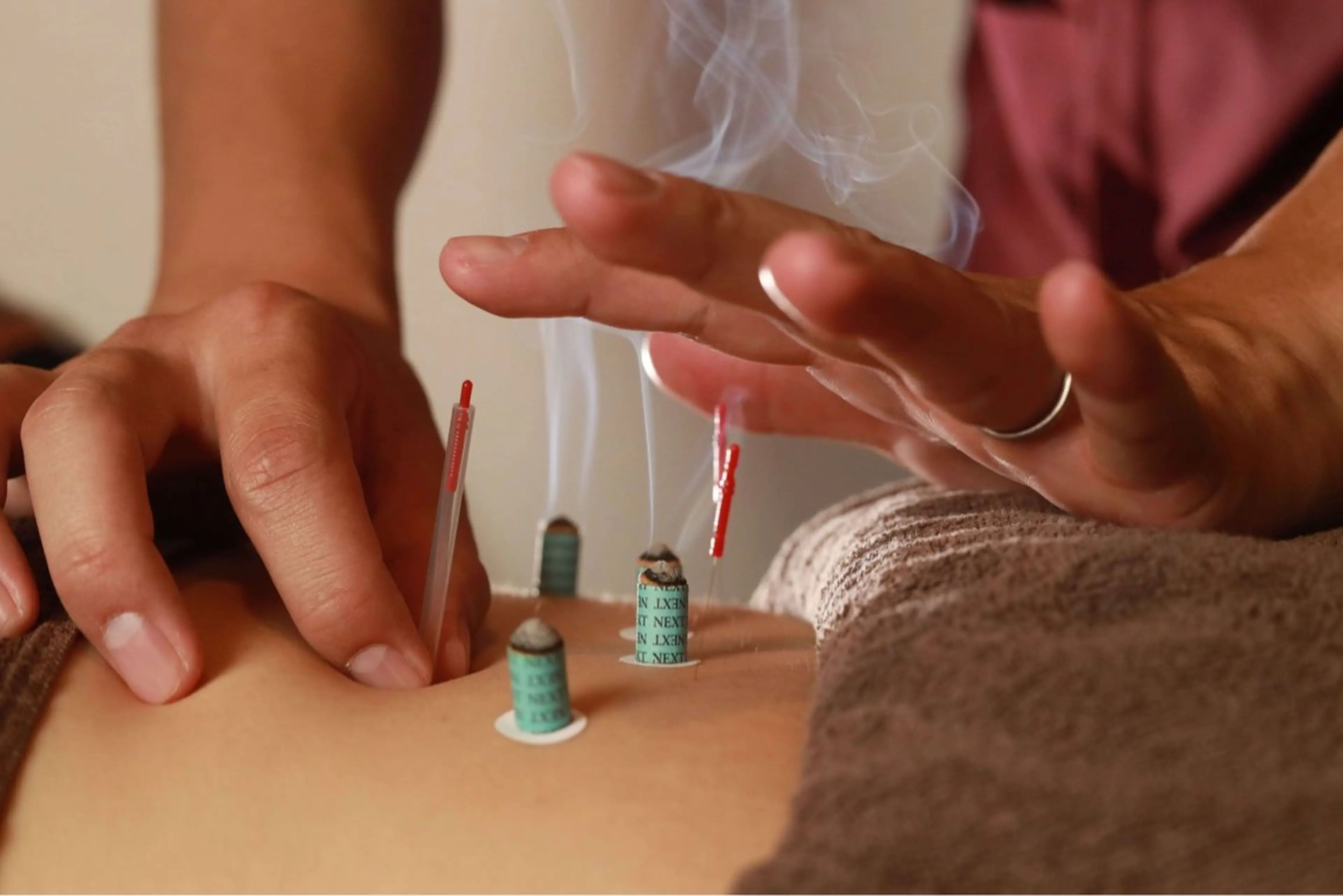 こもれび 鍼灸整骨院のその他イメージ