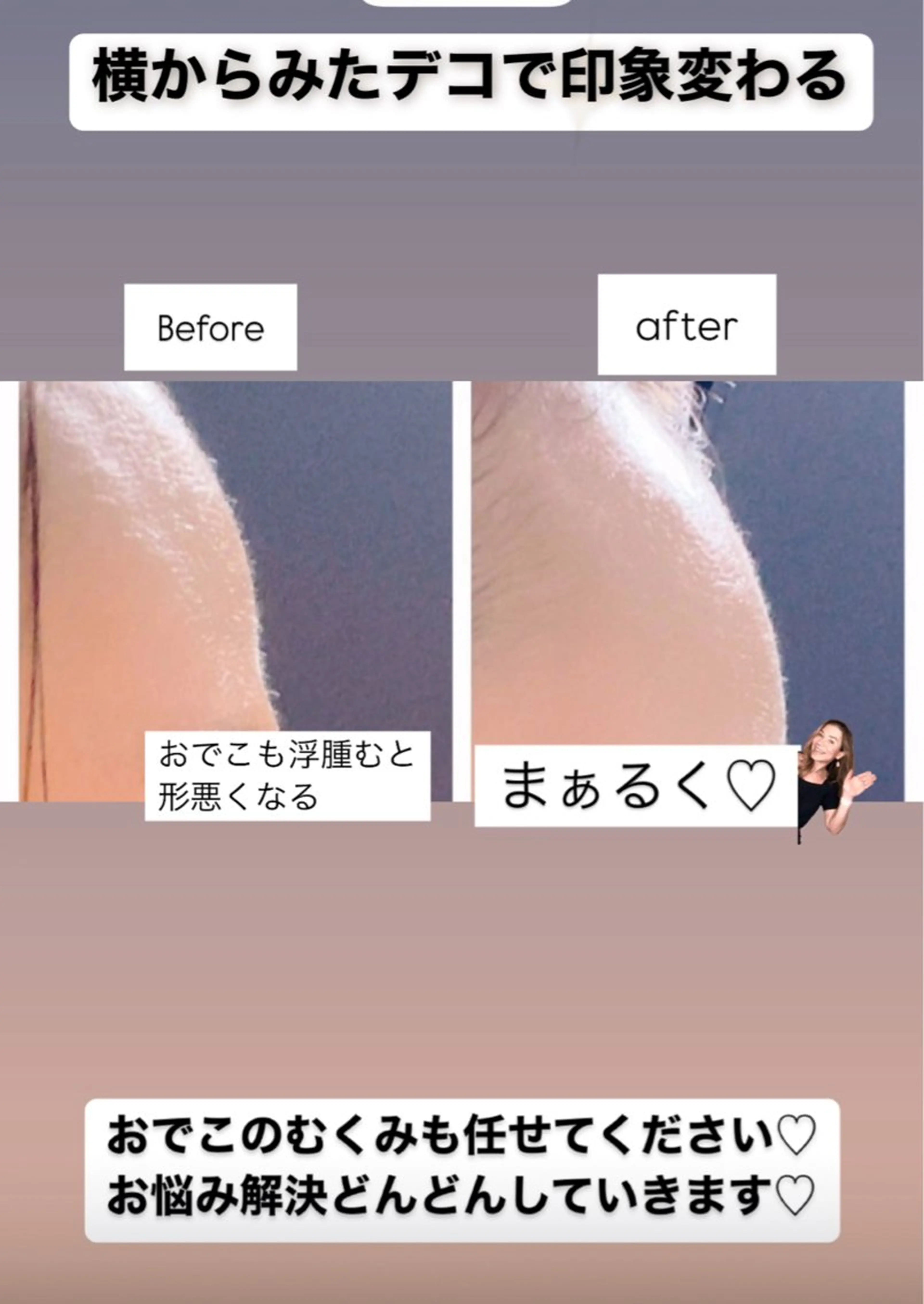 🅖🅤🅩🅔🅛 salonのエステ・リラクイメージ