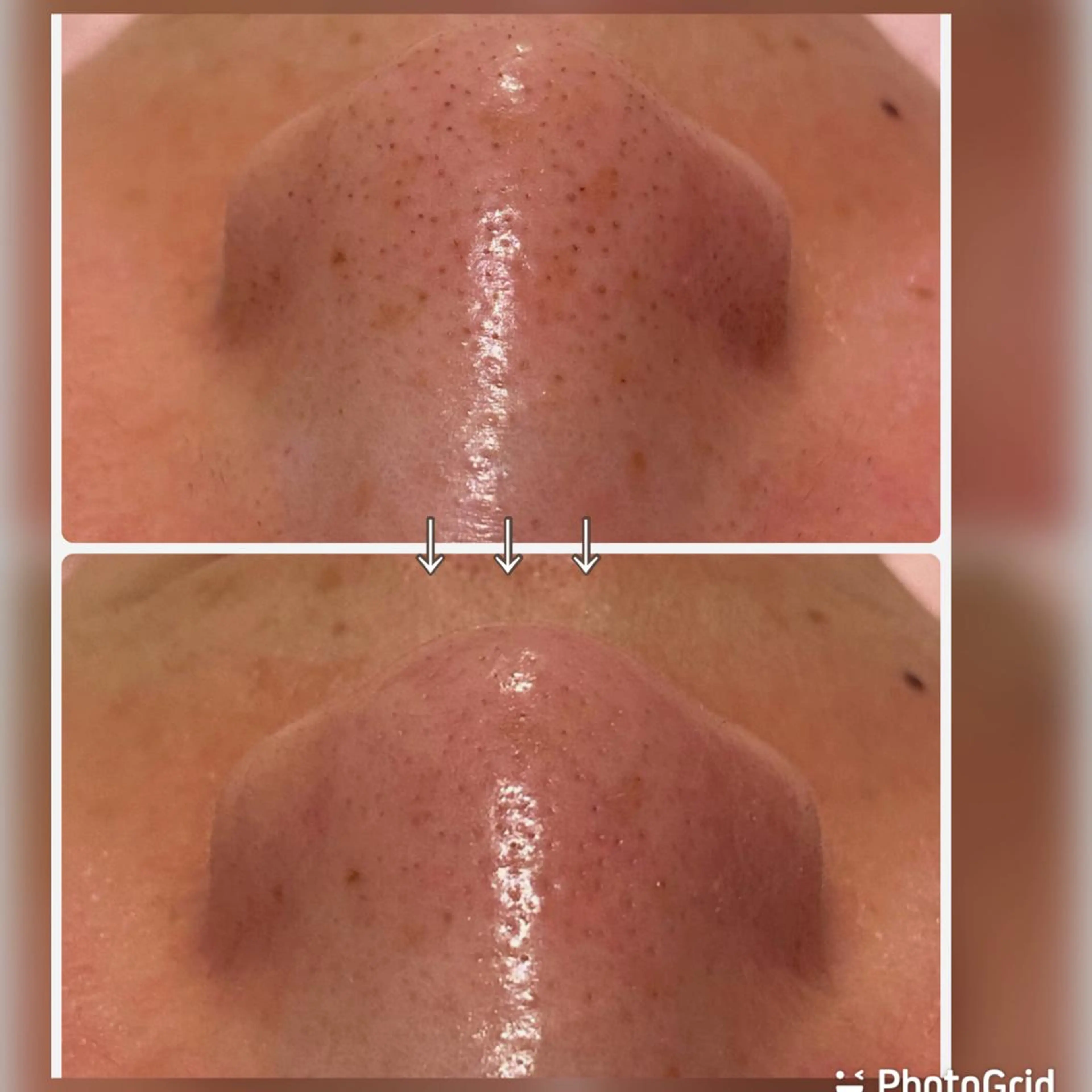 エステ 【リベルハーブピーリング認定店】敏感肌・美白脱毛専門店Dione立川店所属・Dione 立川店のエステ・リラクイメージ