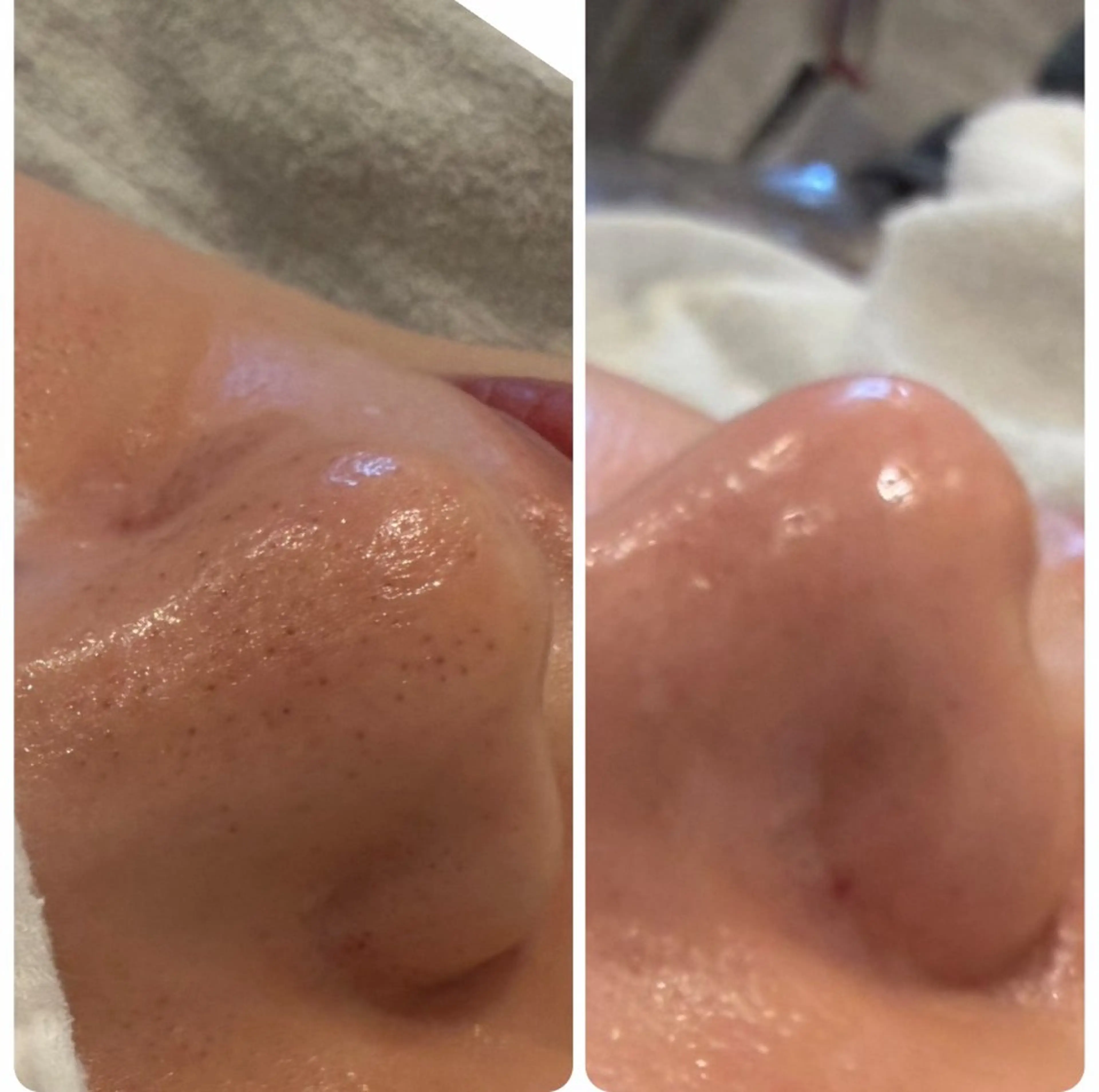 エステ 🅖🅤🅩🅔🅛 salonのエステ・リラクイメージ