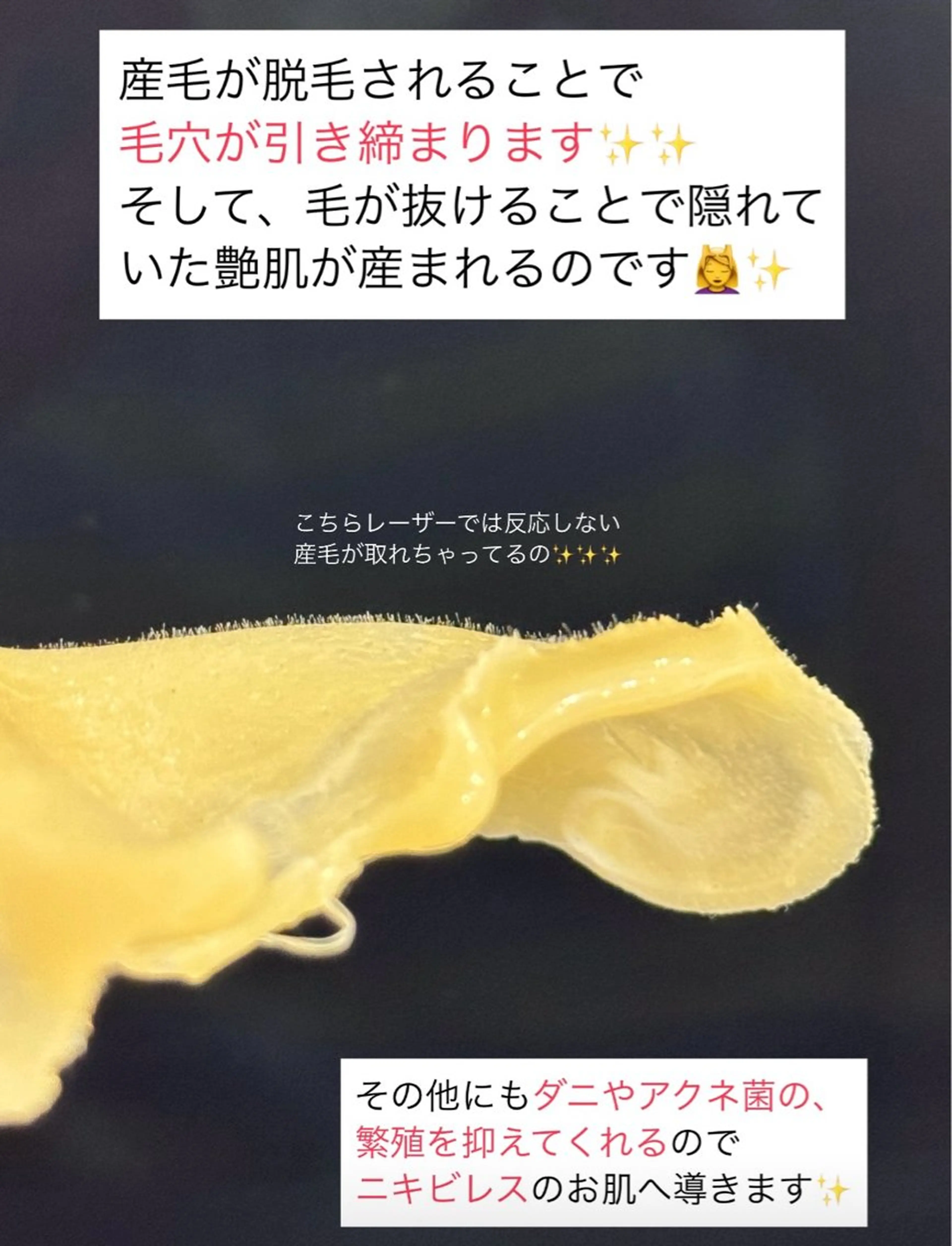 毛穴開き黒ずみ ニキビ特化💆‍♀️のエステ・リラクイメージ