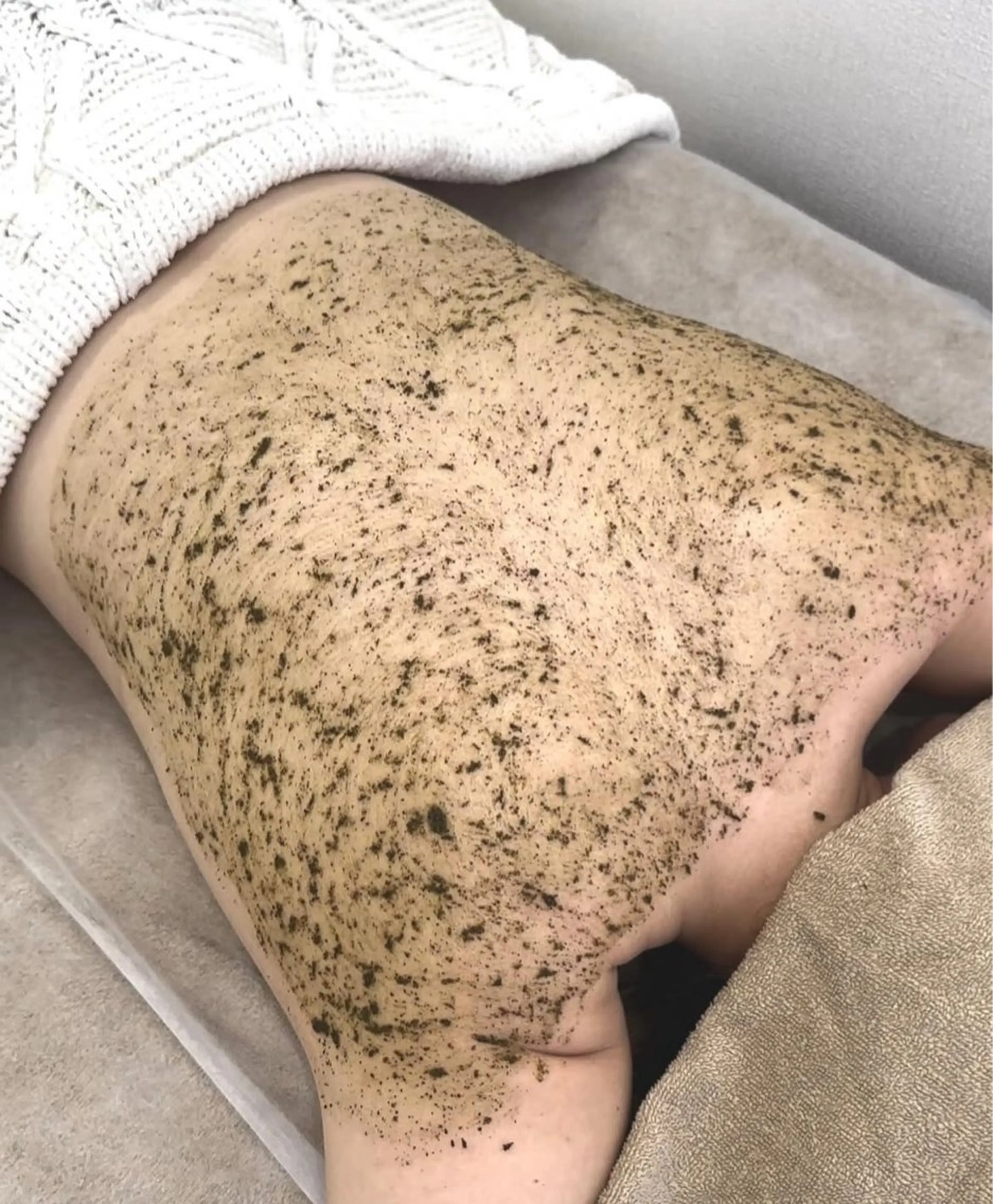 ご新規様限定☆選べるボディハーブピーリング・剥離ありの写真