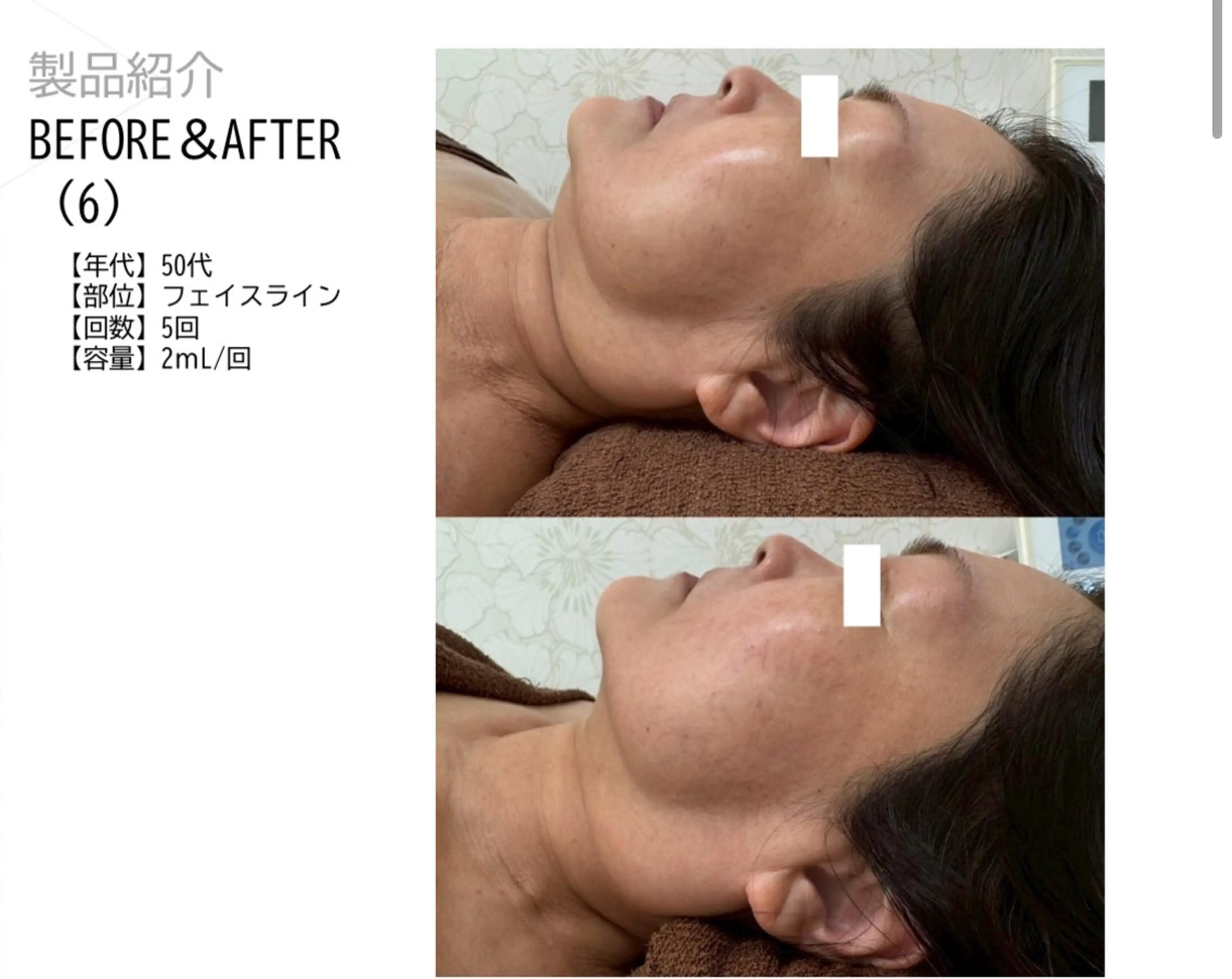 ベルーテ エッセンスのエステ・リラクイメージ