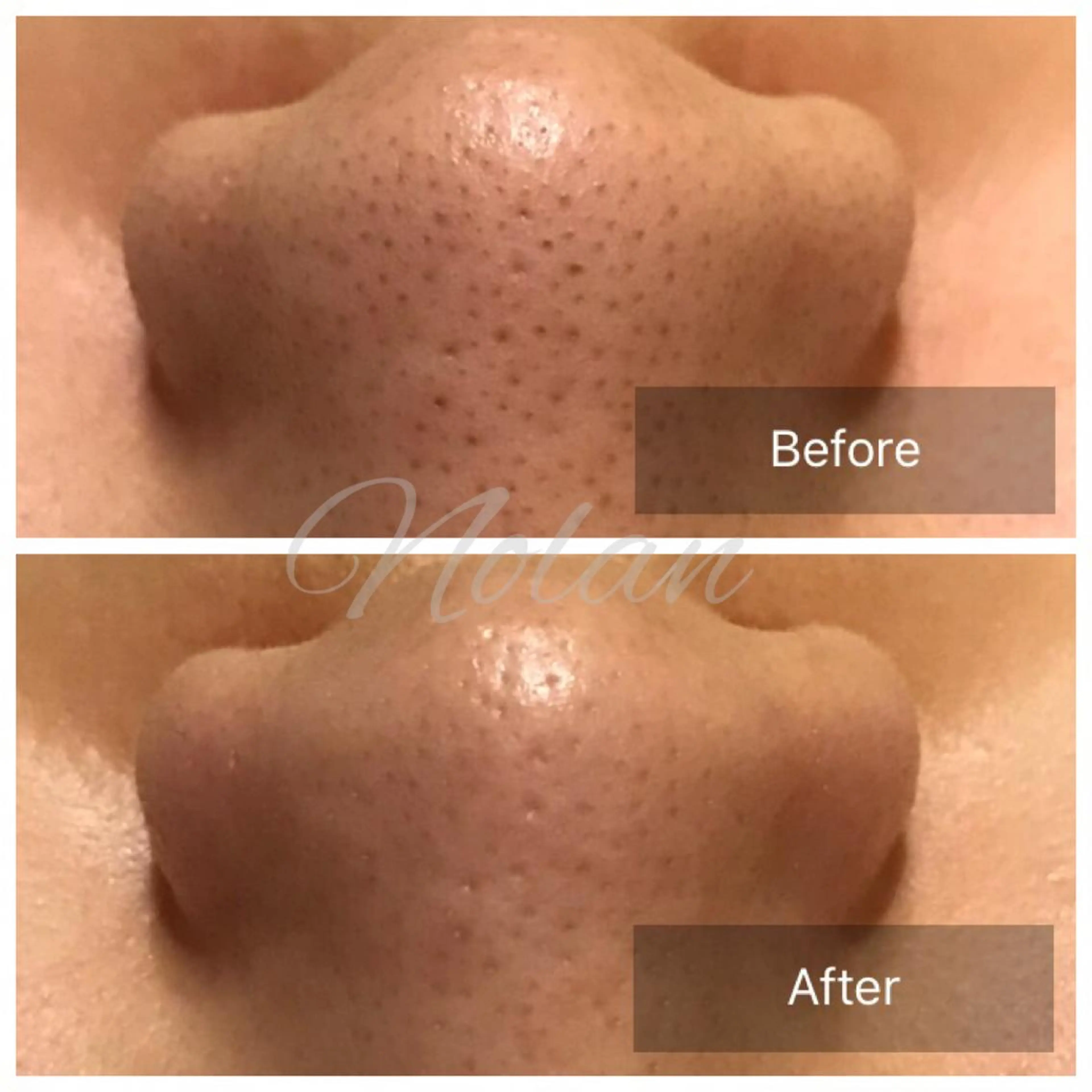 エステ Morisugi Natsumiのエステ・リラクイメージ