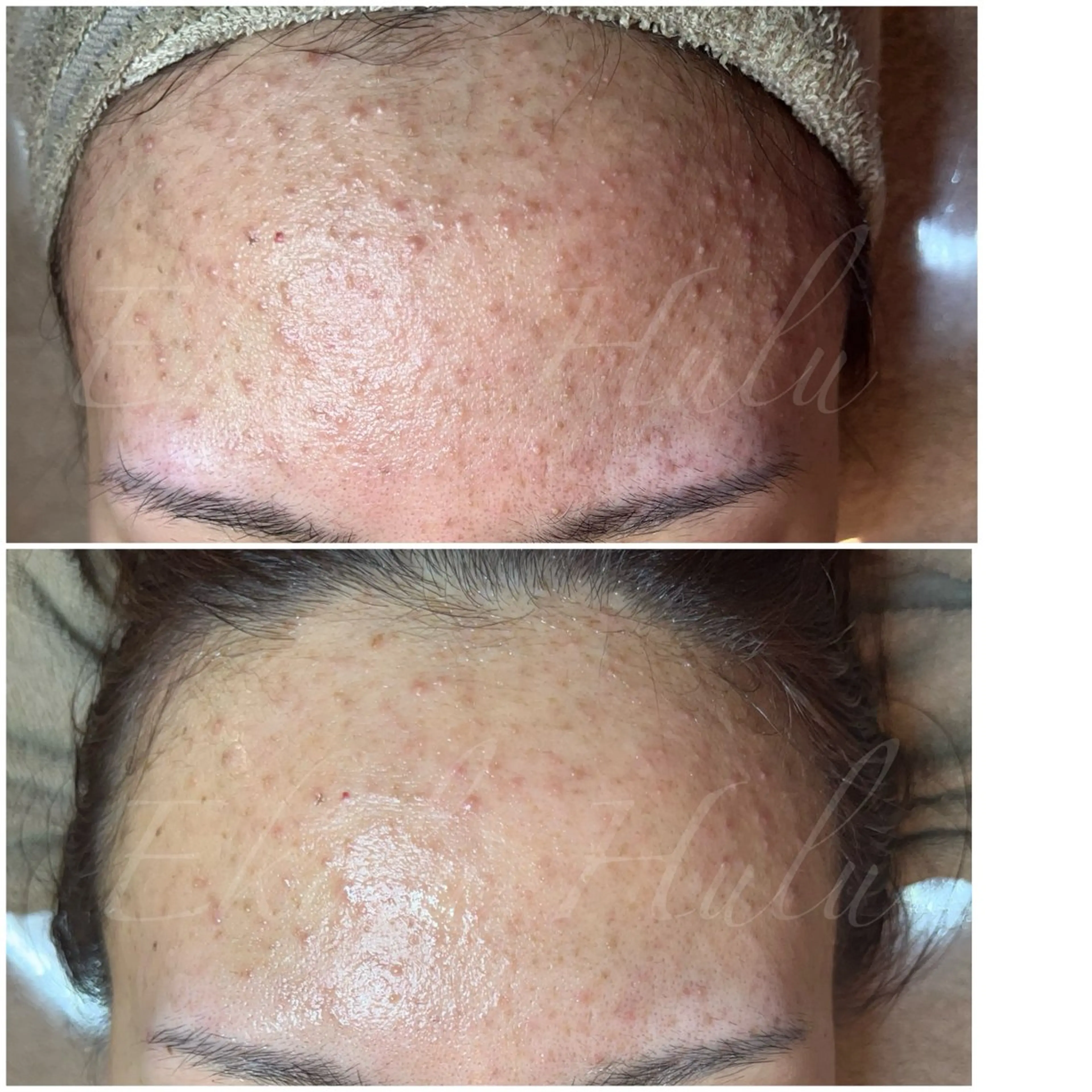 ツヤ肌・美肌サロン (エコル　フル)のエステ・リラクイメージ