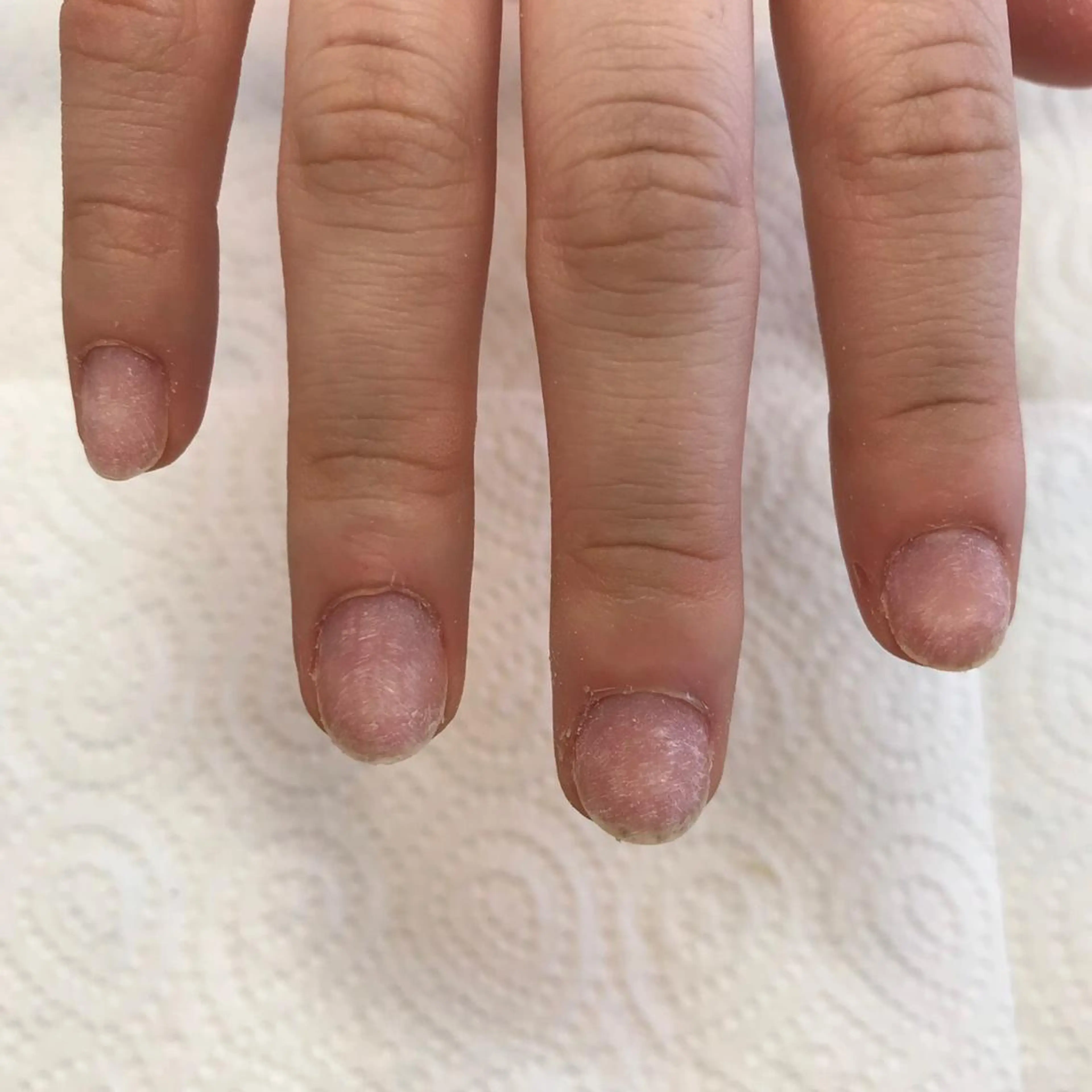 ネイル ネイルリボン 受付スタッフのネイルデザイン