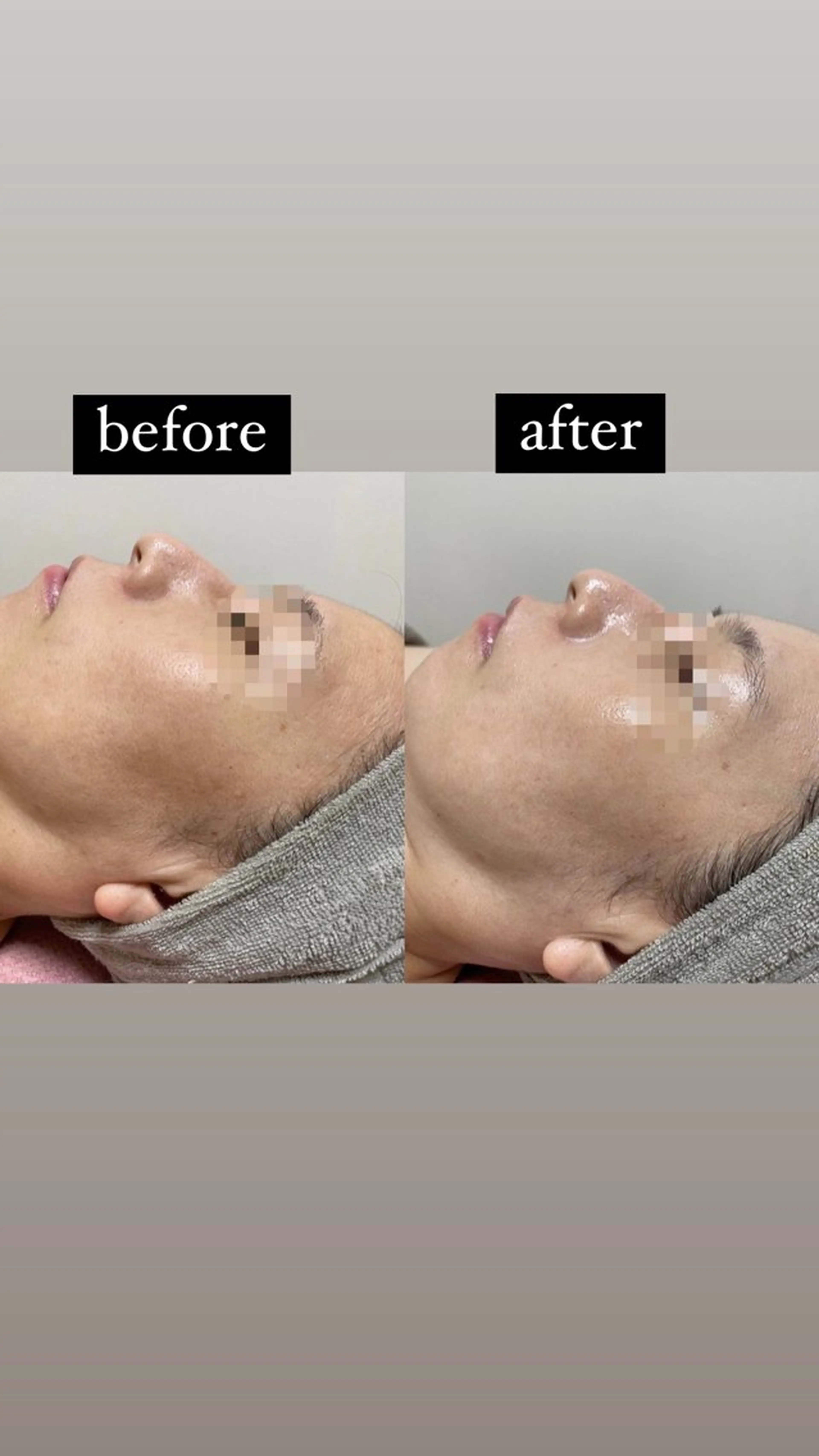 伊藤 順子のその他イメージ