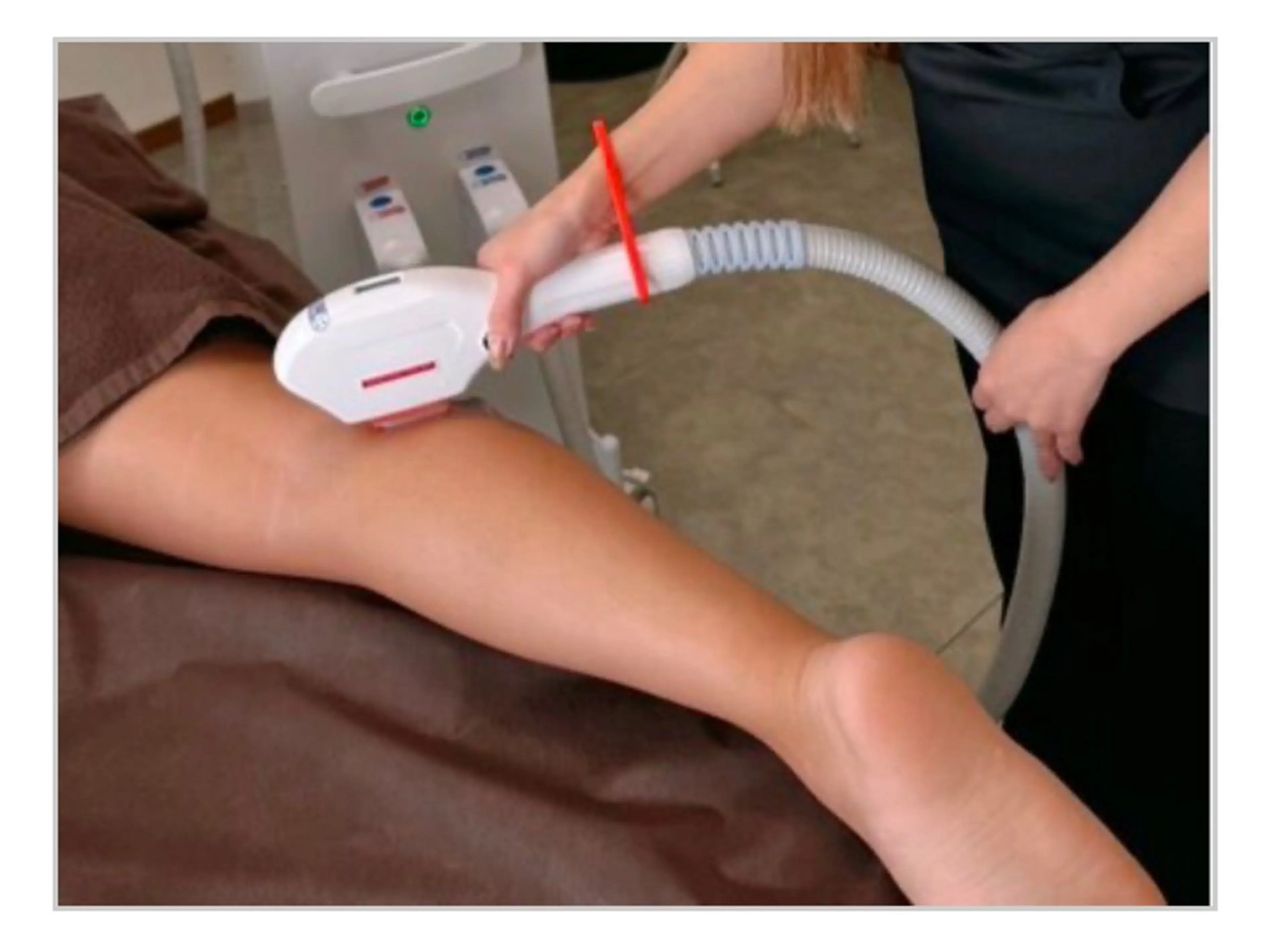 メンズ ハーブピーリング/韓国肌管理/フェイシャル/毛穴洗浄/眉毛/顔脱毛【糸脱毛専門】rev所属・ハーブピーリング専門 毛穴洗浄❤️眉waxのエステ・リラクイメージ