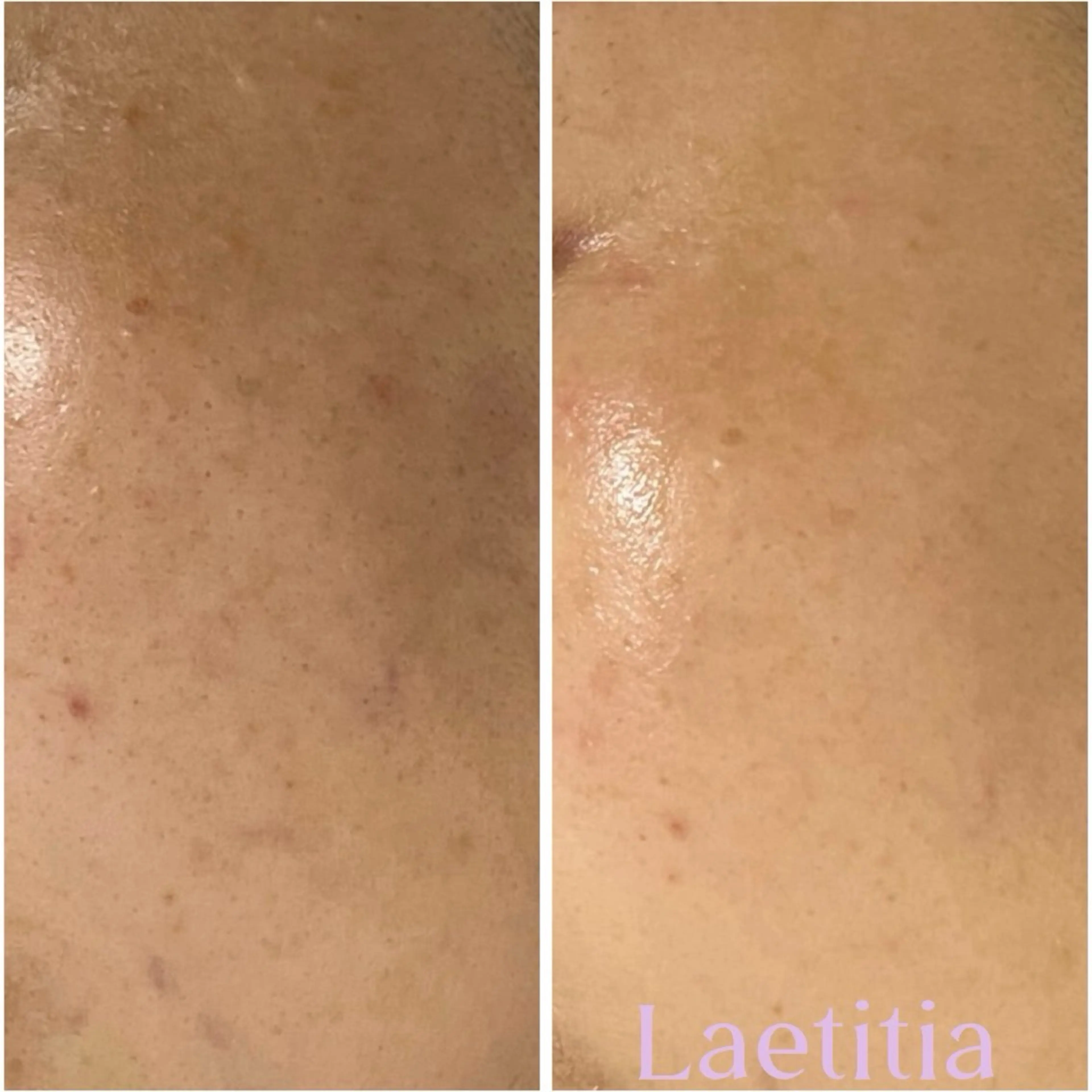 エステ レティティア【Laetitia】所属・レティティア秋葉原店 Yoshizawaのエステ・リラクイメージ