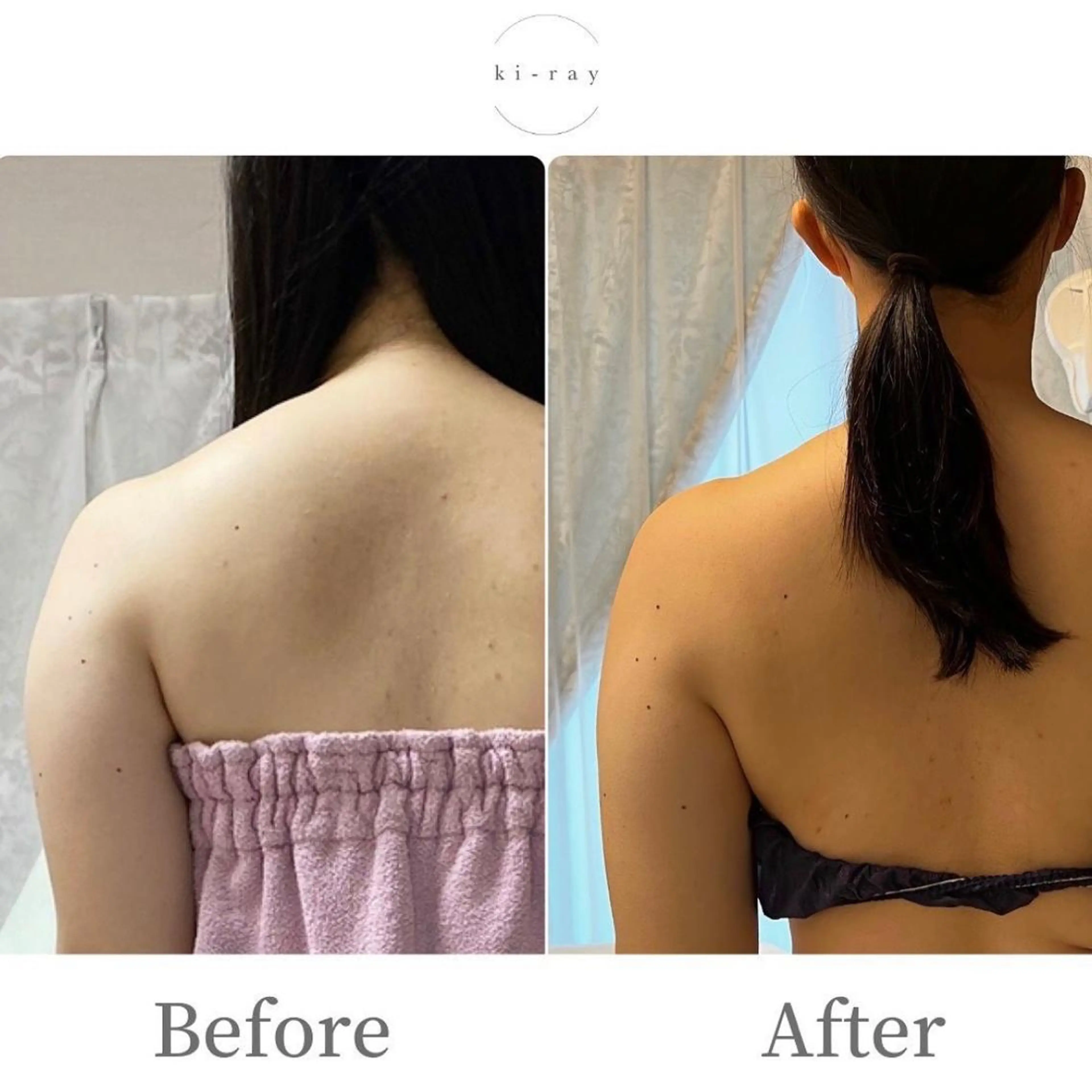 エステ 綺麗のひみつ グランプリ受賞店のエステ・リラクイメージ