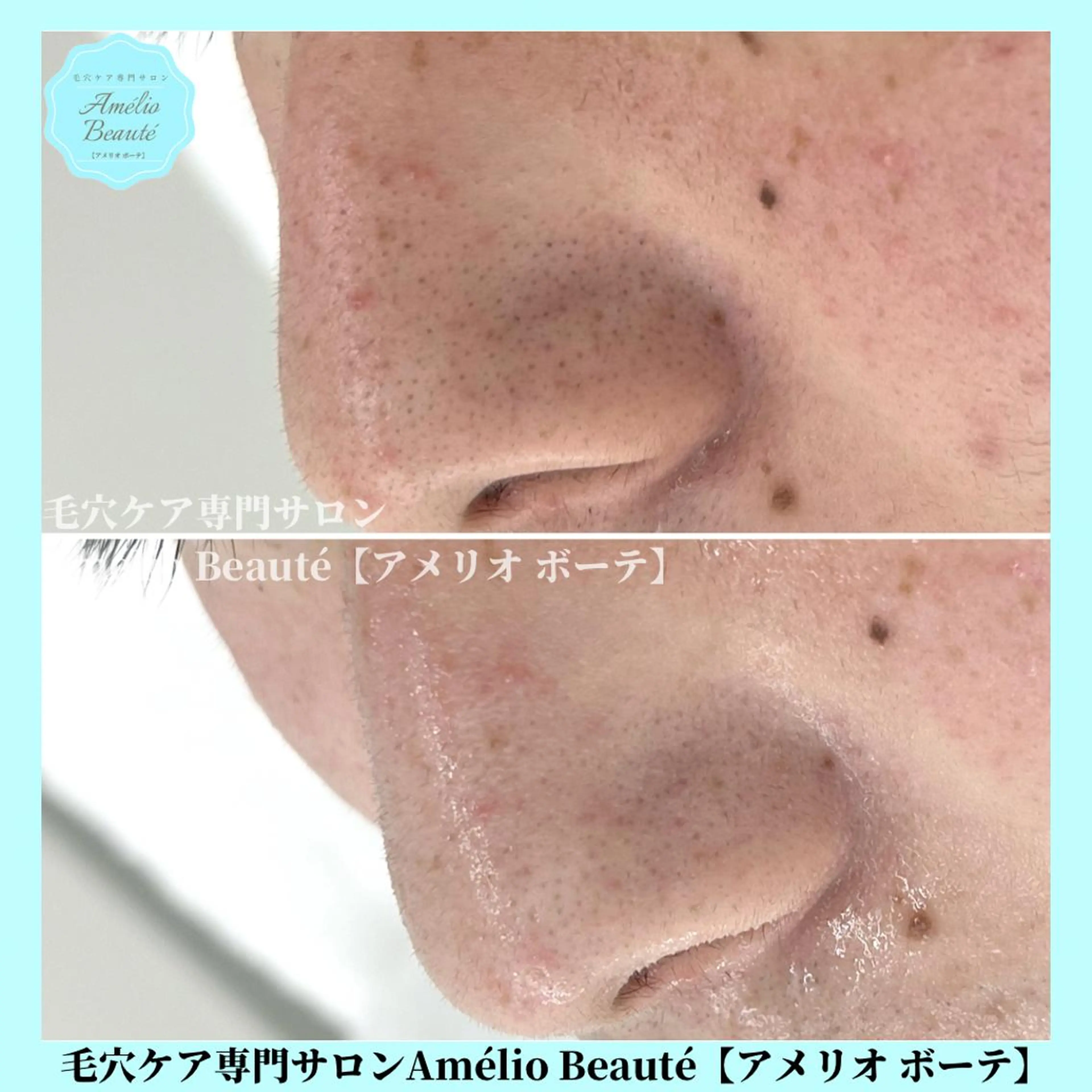 メンズ 毛穴ケア専門サロン アメリオボーテのその他イメージ