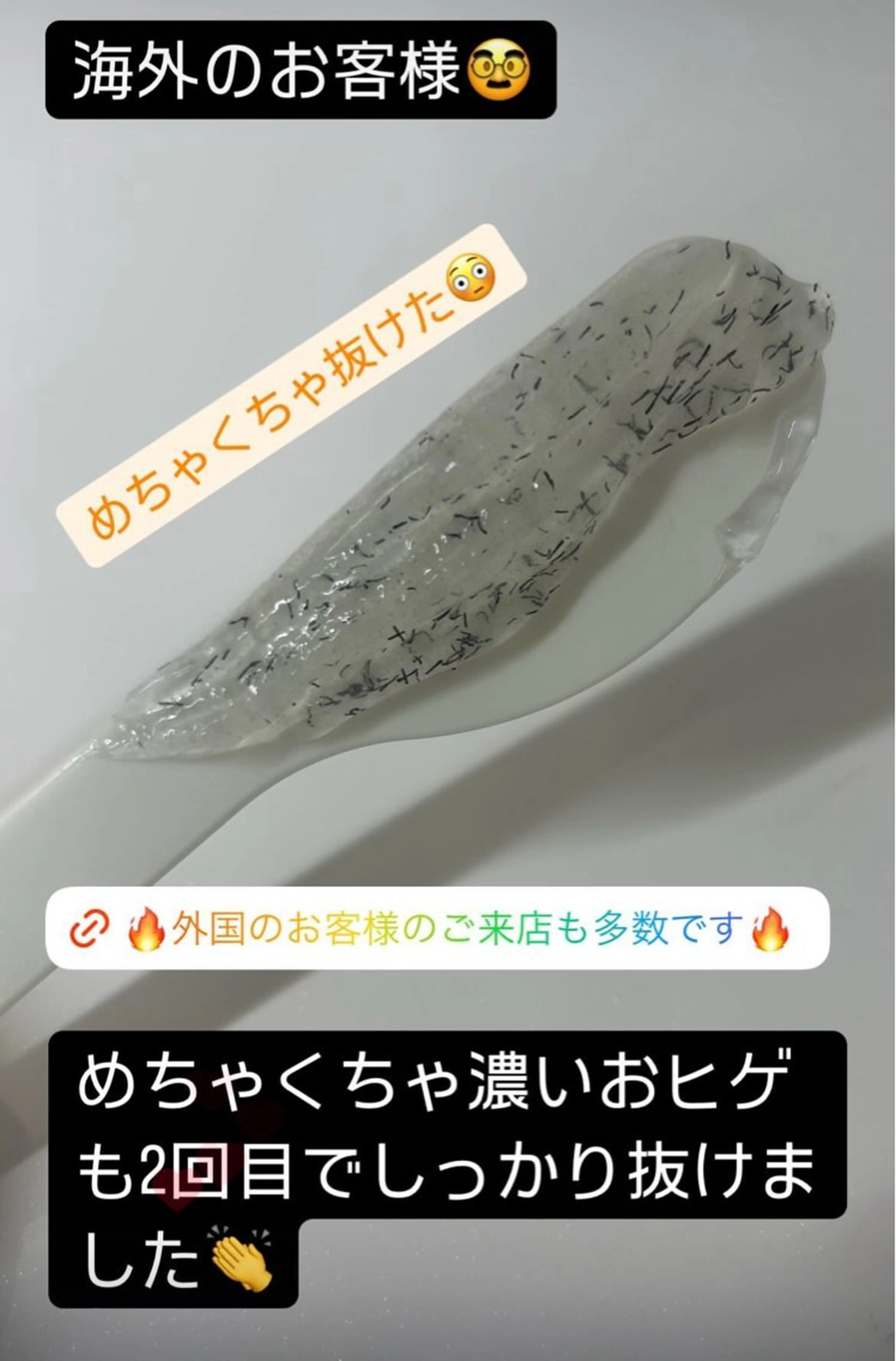 メンズ 脱毛 脱毛サロン BRIDGE橋本のエステ・リラクイメージ