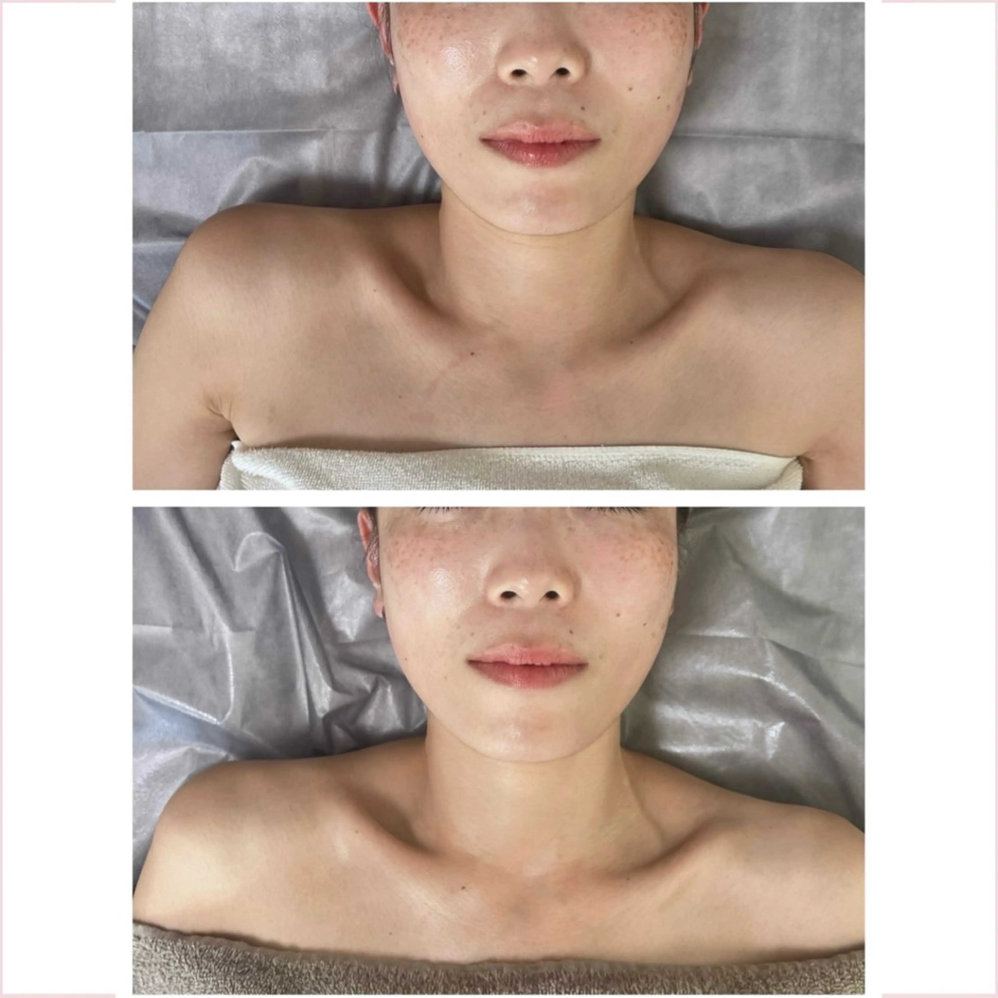 肌のお悩み改善サロン MELIA/朋美のエステ・リラクイメージ