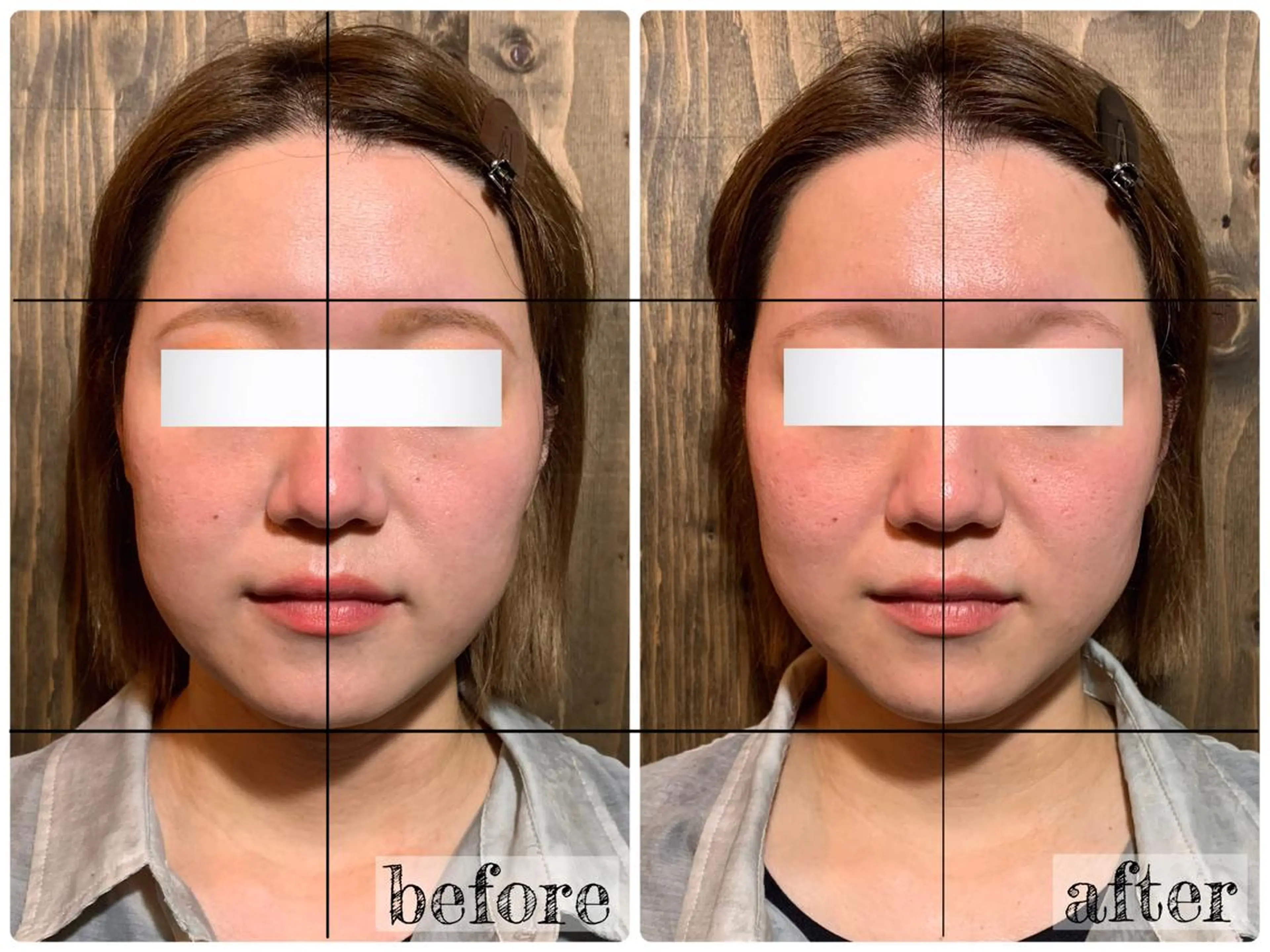 エステ リラク 💎後悔させない小顔 矯正💎イトヤマ🌱のエステ・リラクイメージ