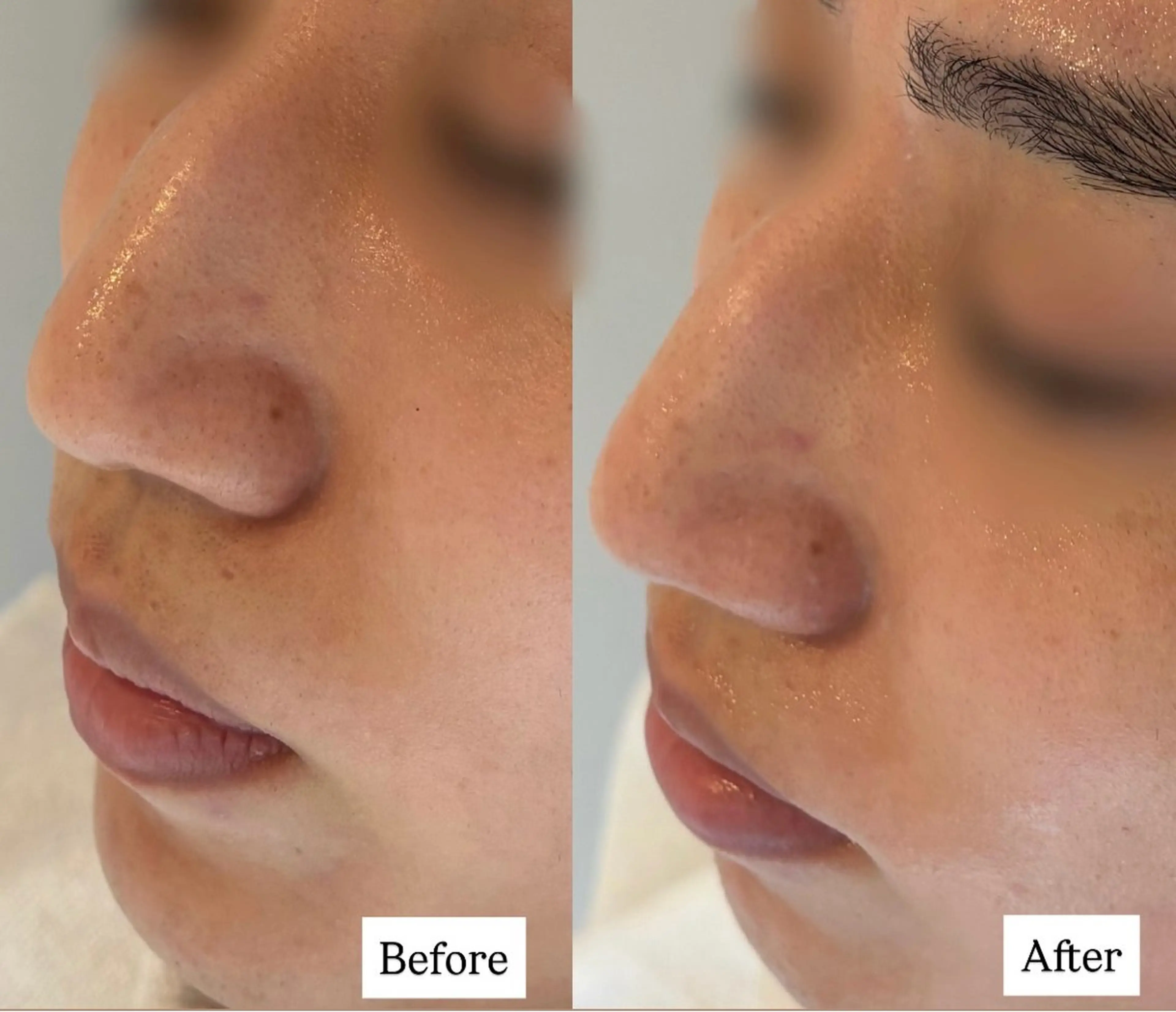 POLA 大阪福島店のエステ・リラクイメージ