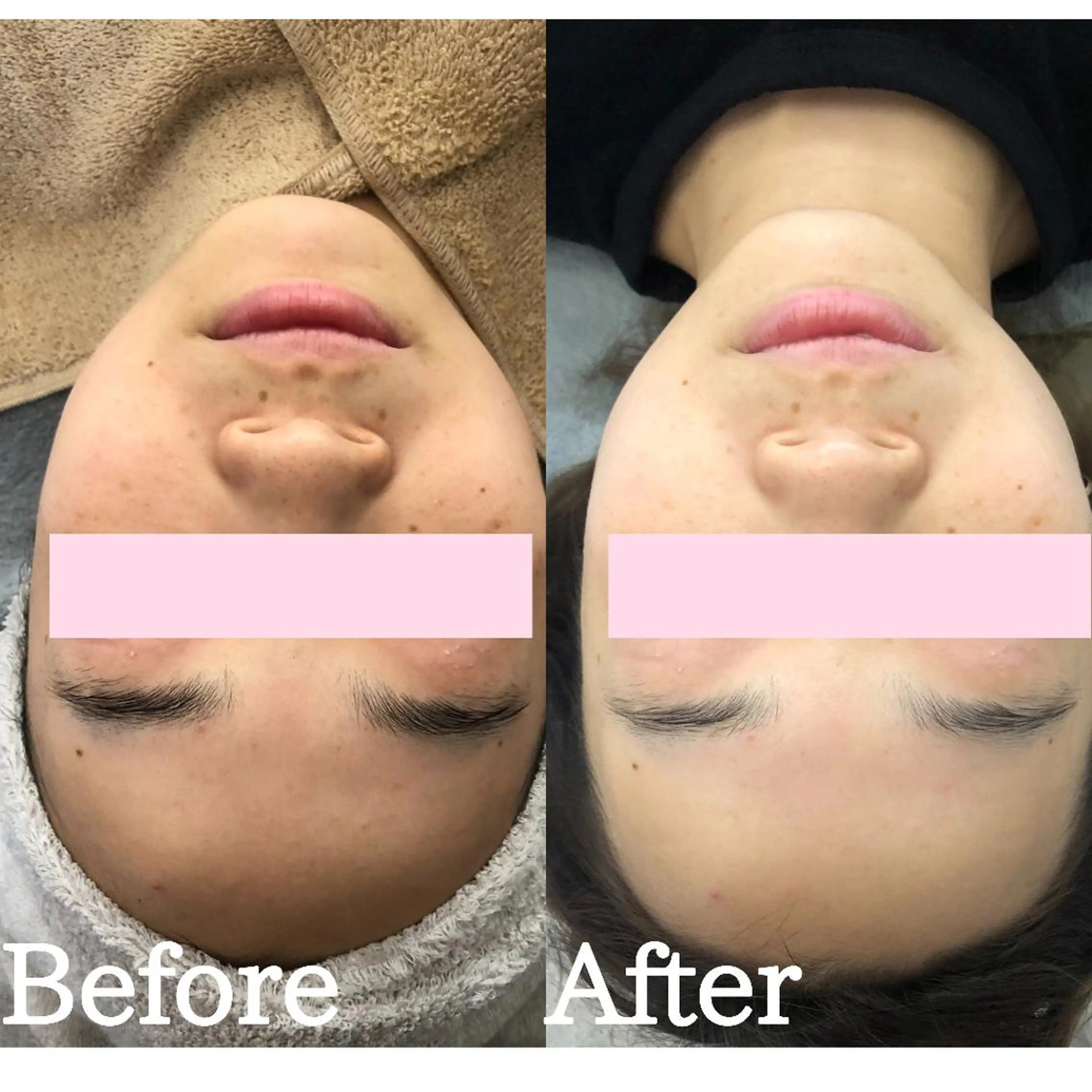 BestBelleꕤ 大阪福島/肌質改善のエステ・リラクイメージ