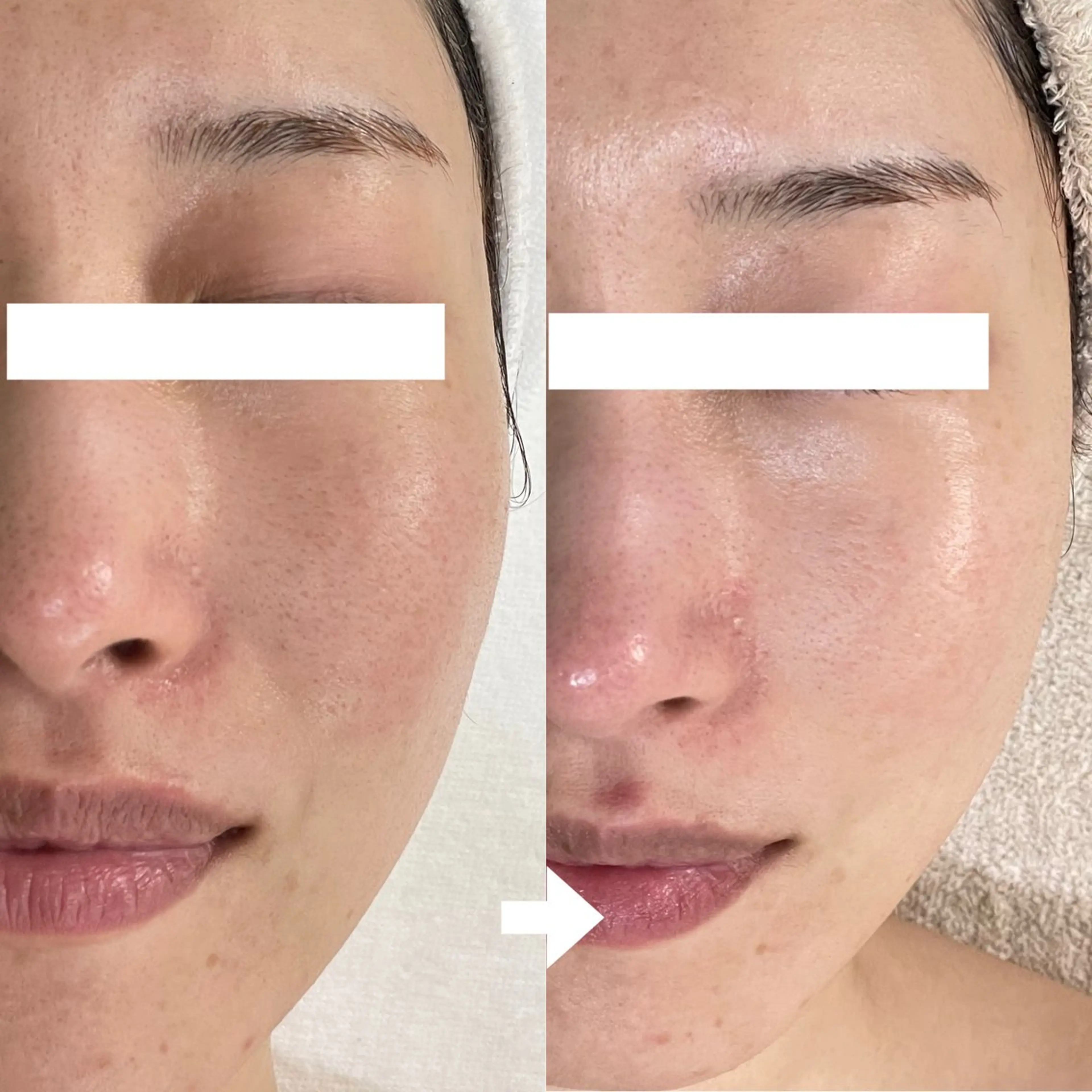 ニキビ・毛穴・ フェイシャル専門店のエステ・リラクイメージ