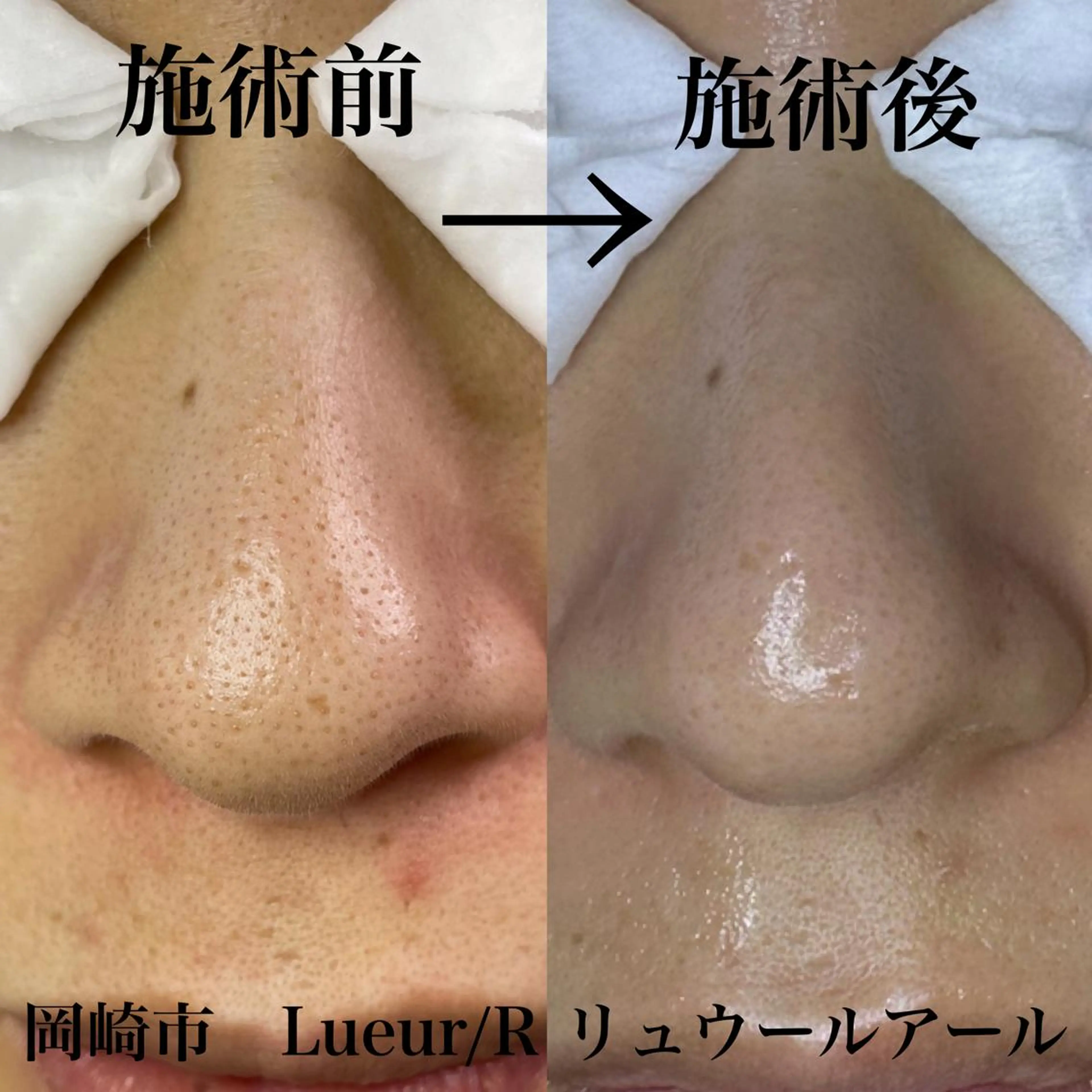 エステ 大久保 里奈のエステ・リラクイメージ