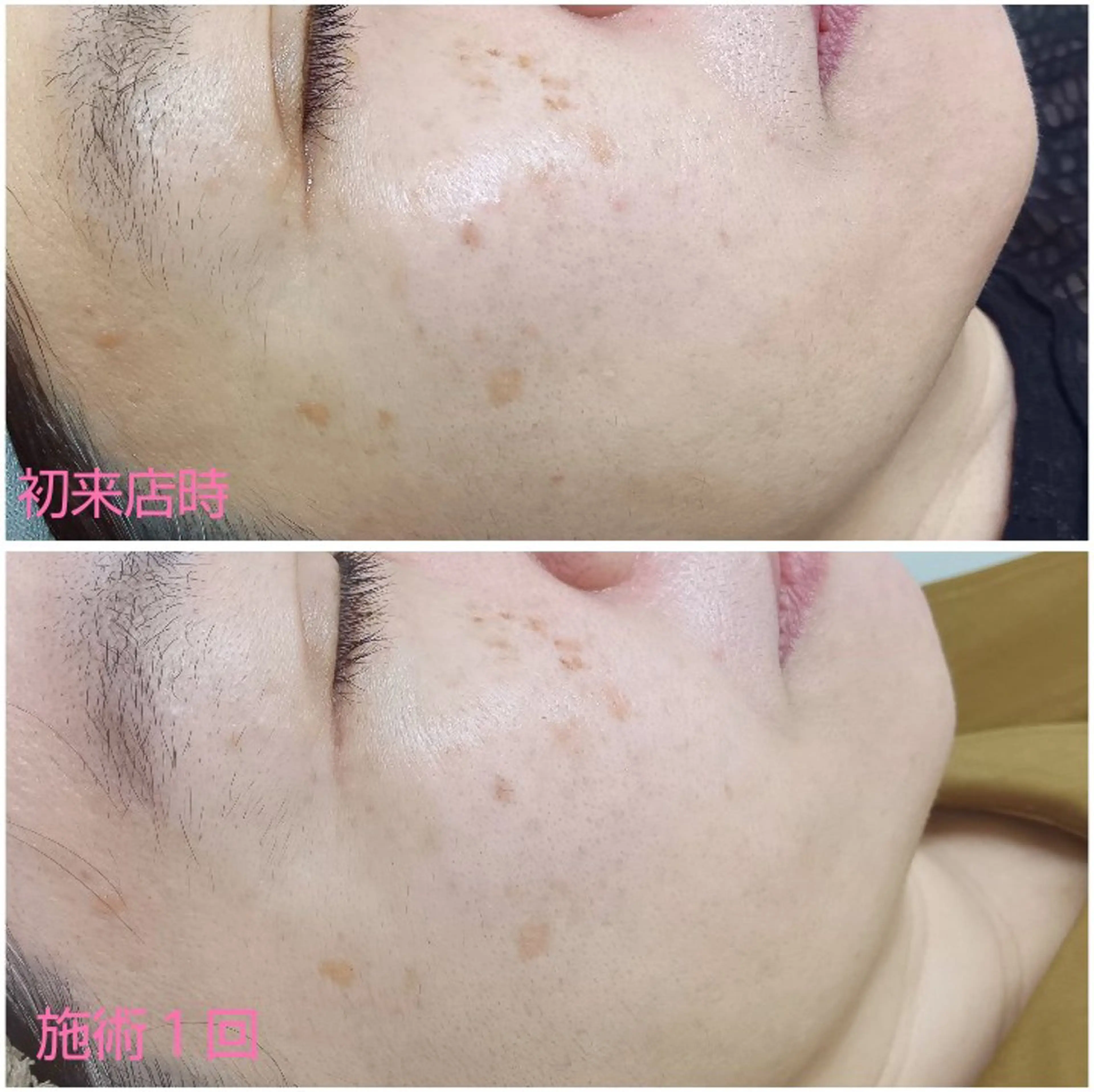 シミケア専門店 HAQUAのエステ・リラクイメージ