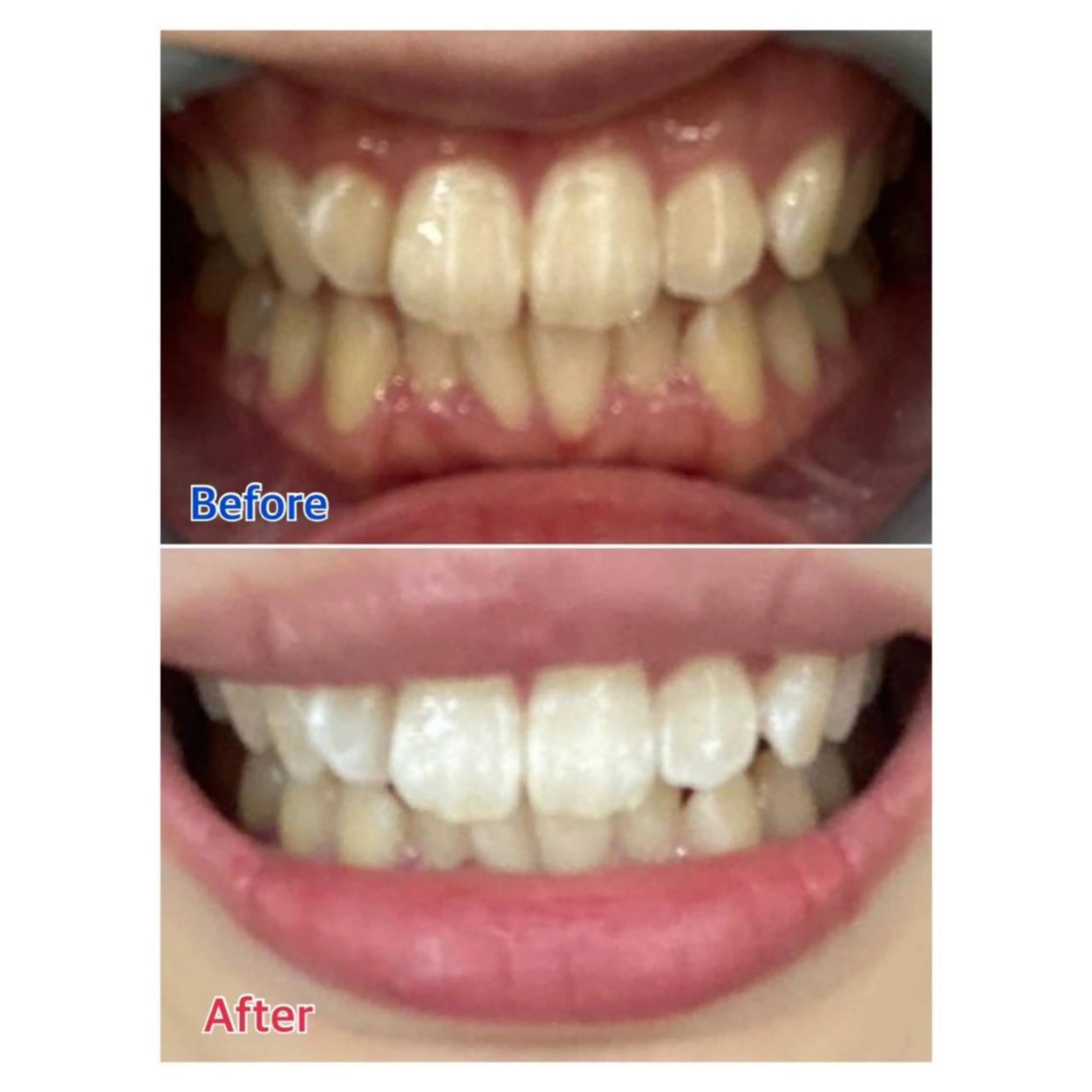 MBEAUTYSALON 千葉店・京成大久保所属・Melty 輝のその他イメージ