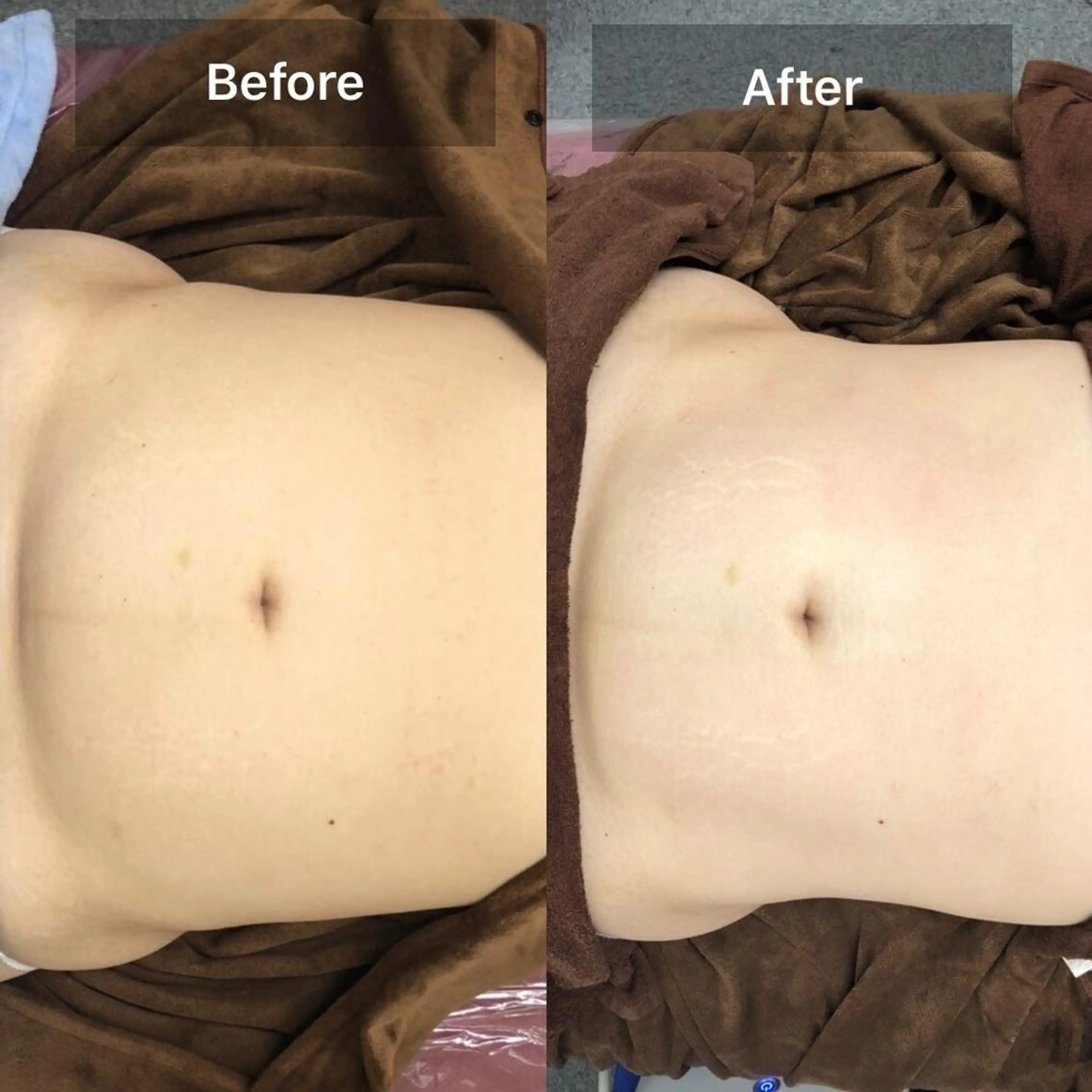 +charm mihoのエステ・リラクイメージ