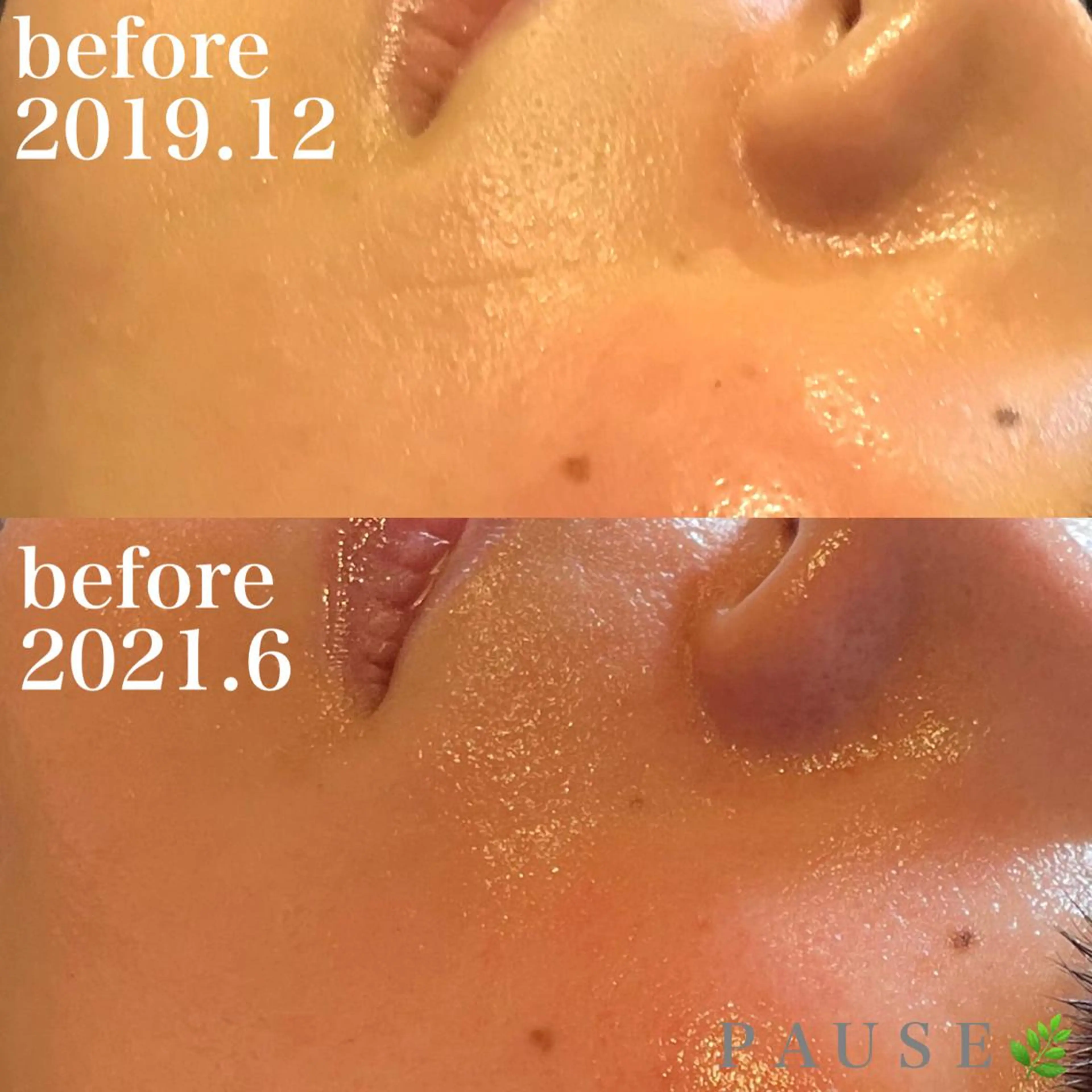 エステ 浜野 恵美のエステ・リラクイメージ