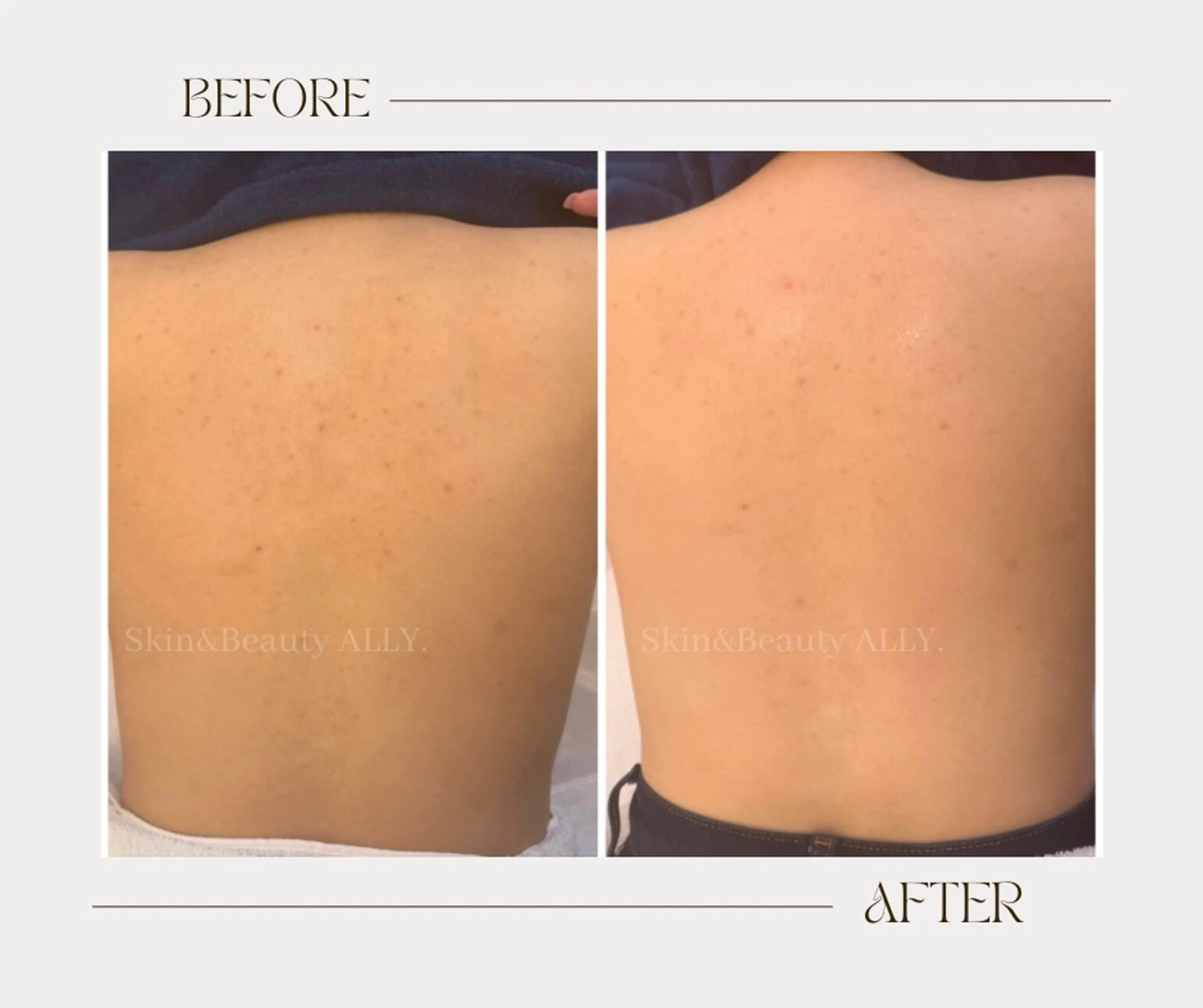 エステ 艶肌ワックス ALLY.のエステ・リラクイメージ