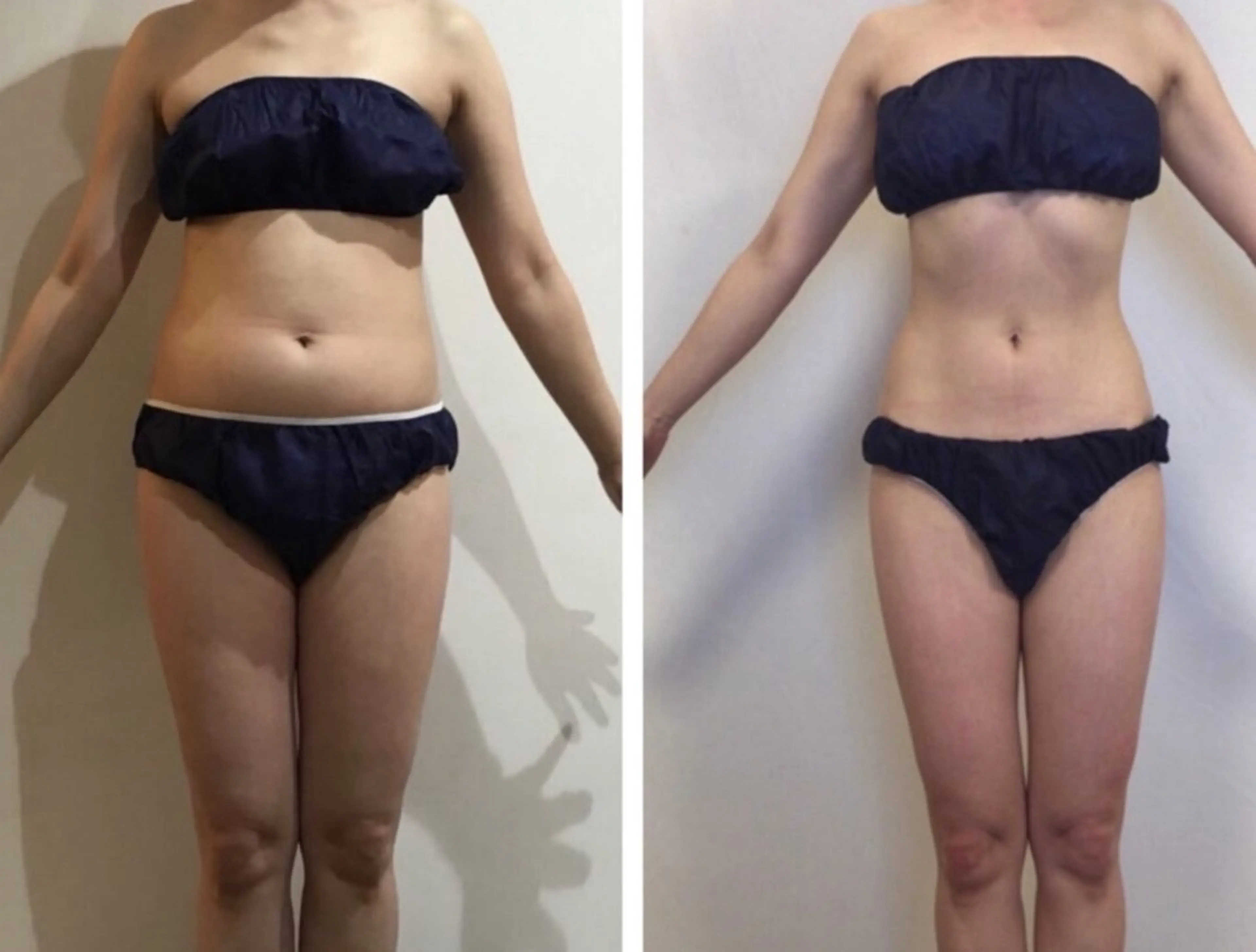 【ボディメイク/サイズダウン】温活×リンパ×全身痩身の写真