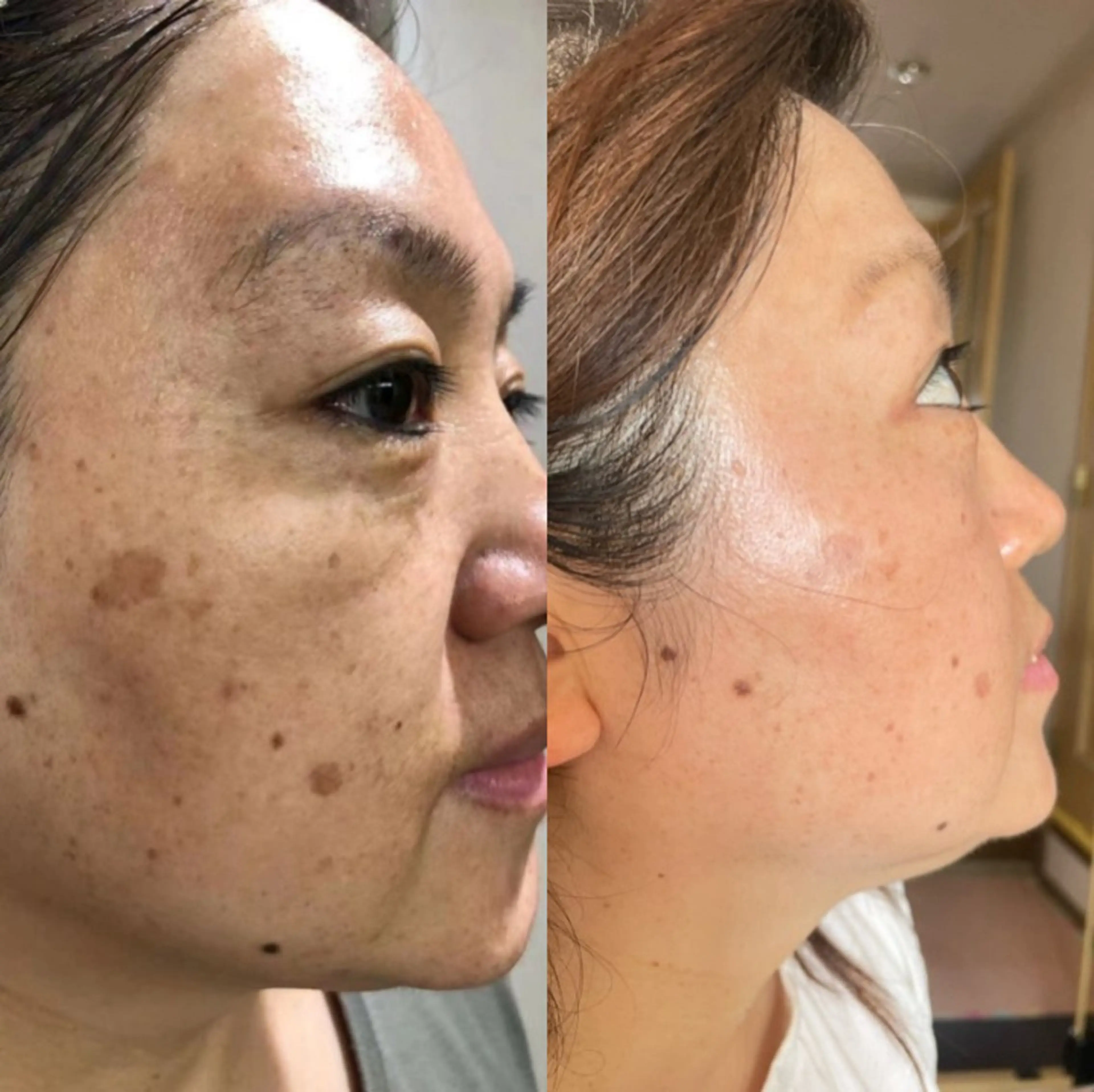 エステ 上福岡 らんらんのネイルデザイン