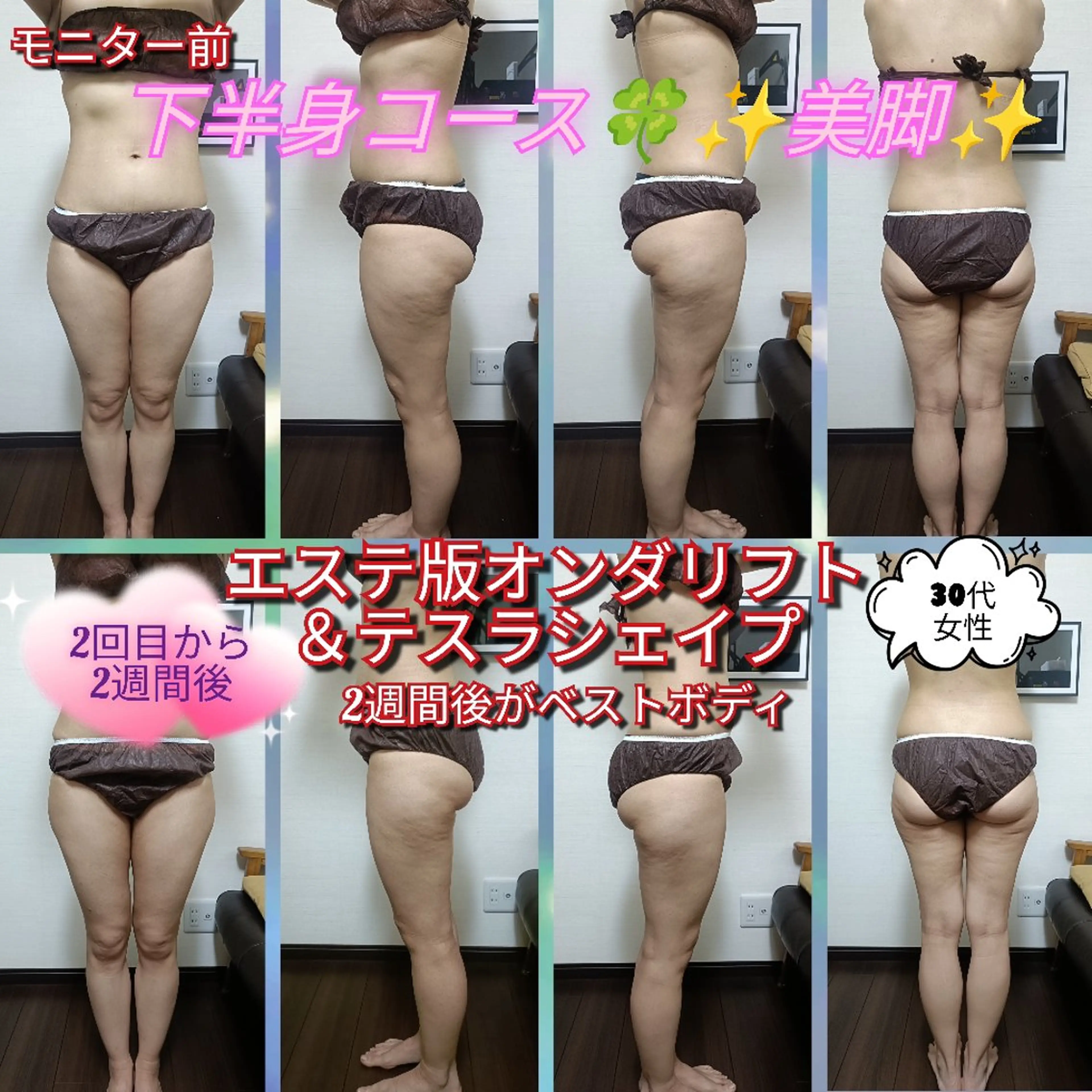 美脚🌈脂肪＆筋肉コース！エステ版オンダリフト35分テスラシェイプ15分☓2箇所の写真