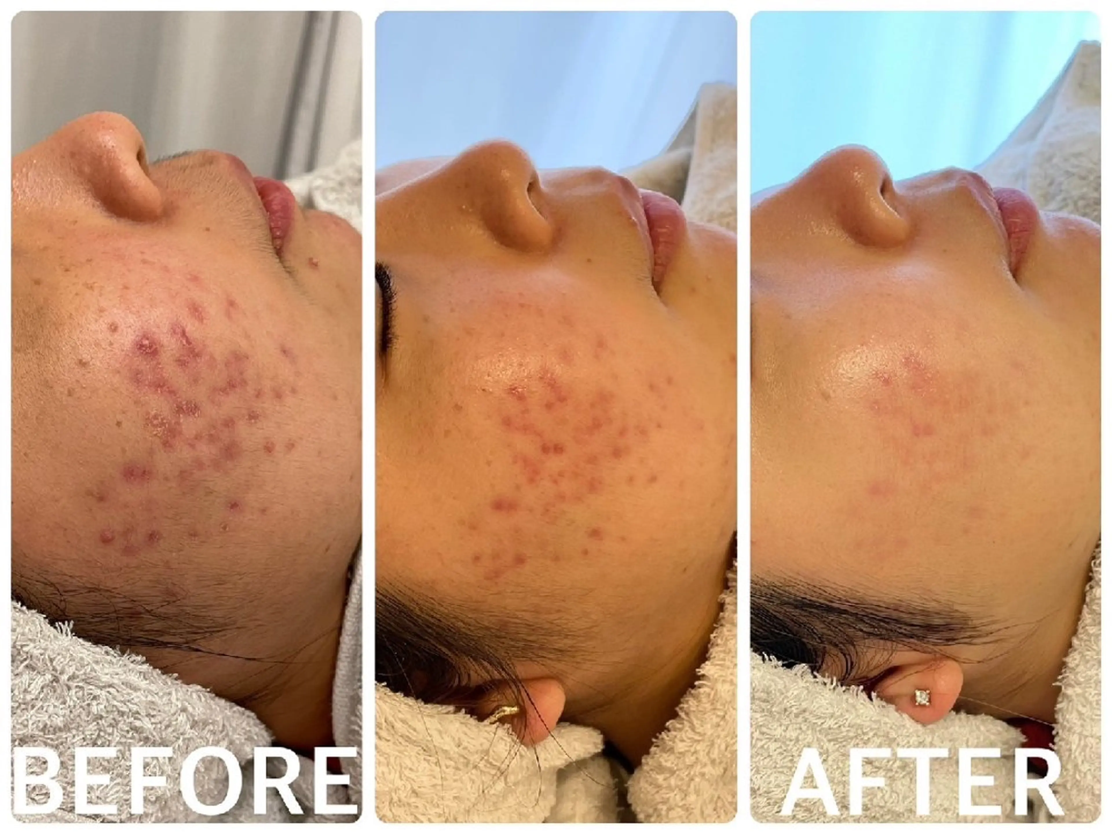 ハーブピーリング横浜 肌質改善専門店のその他イメージ