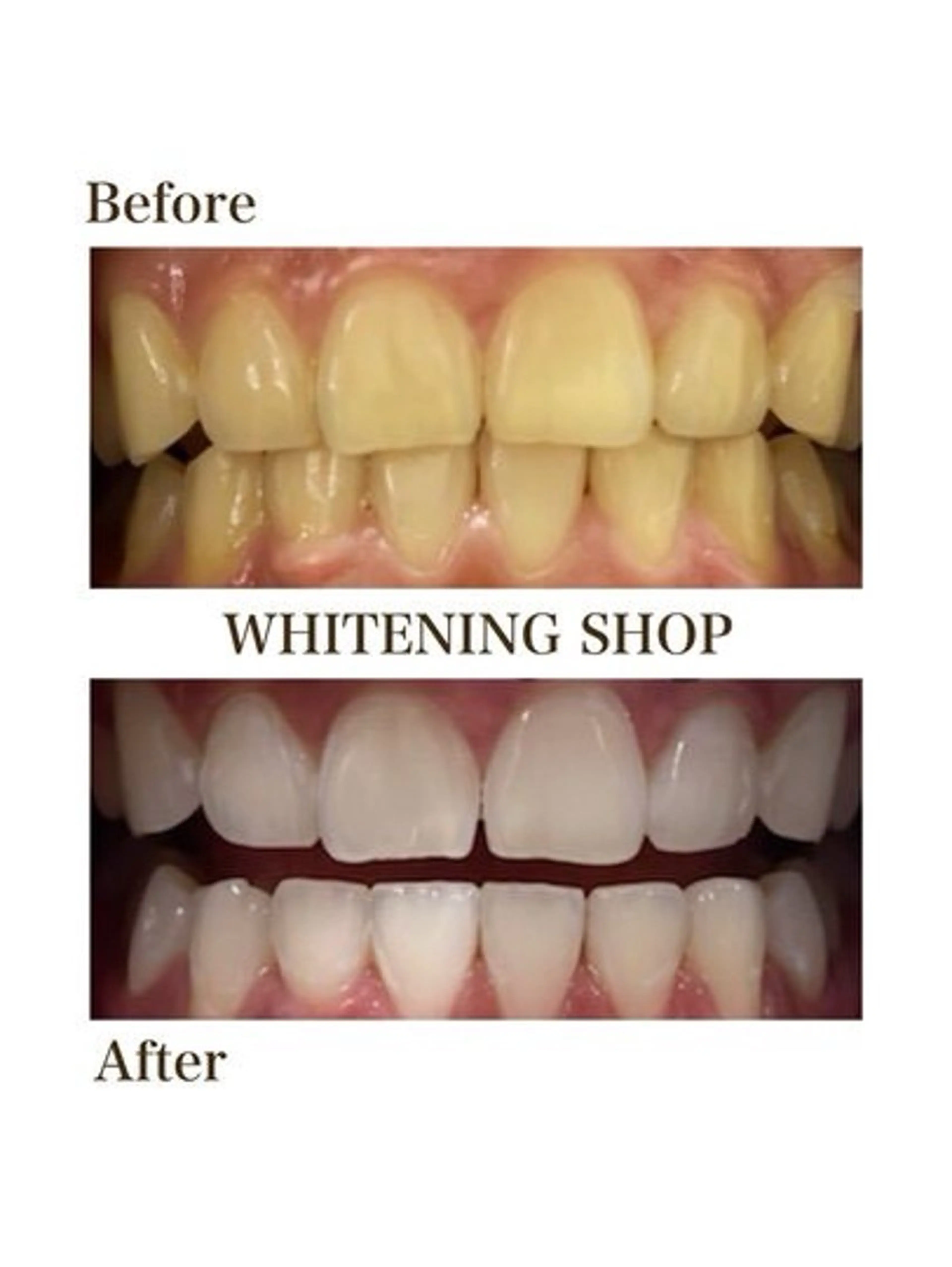 その他 ホワイトニング ショップ津店のその他イメージ