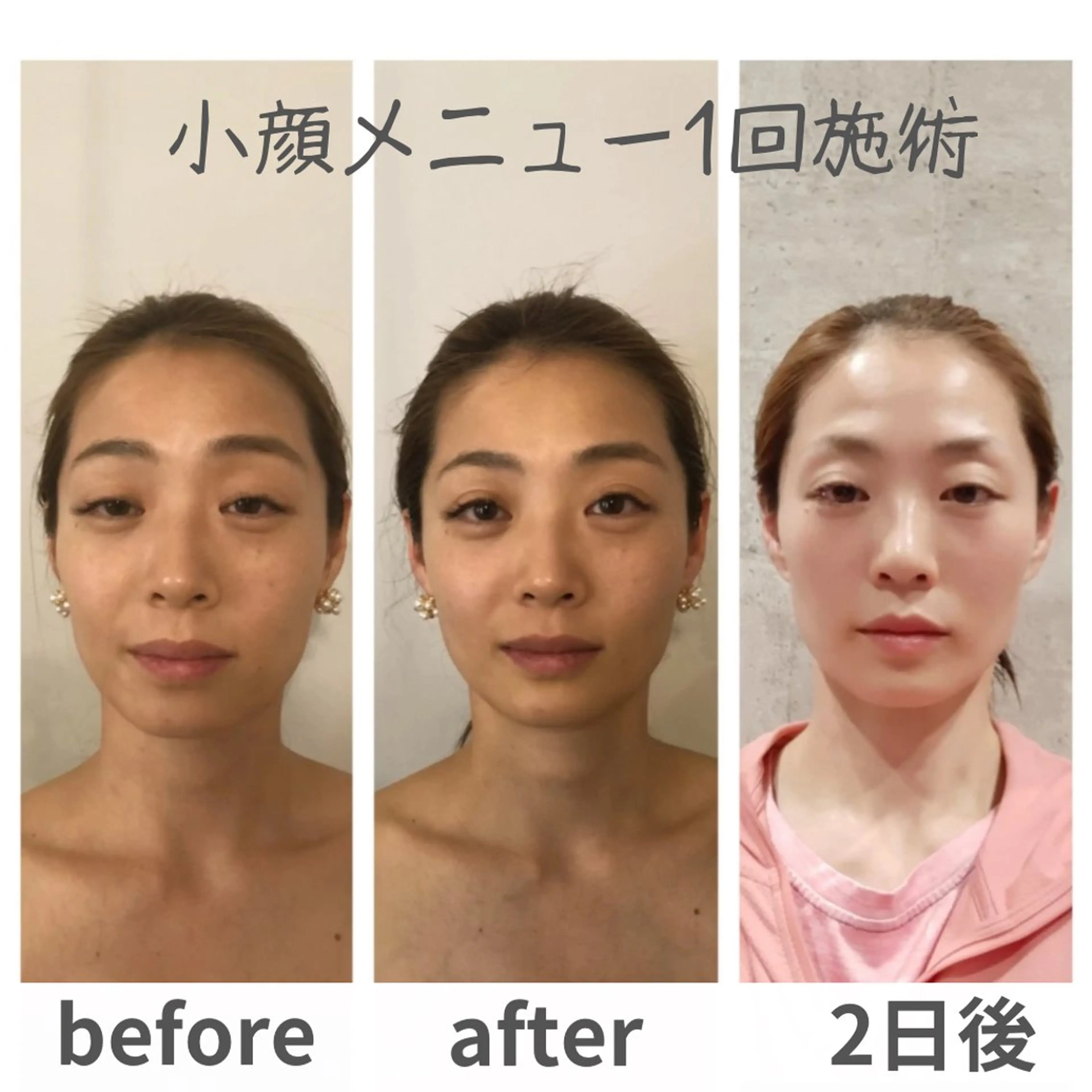 小顔.足痩せ整体 痩身天六Sunaoのその他イメージ