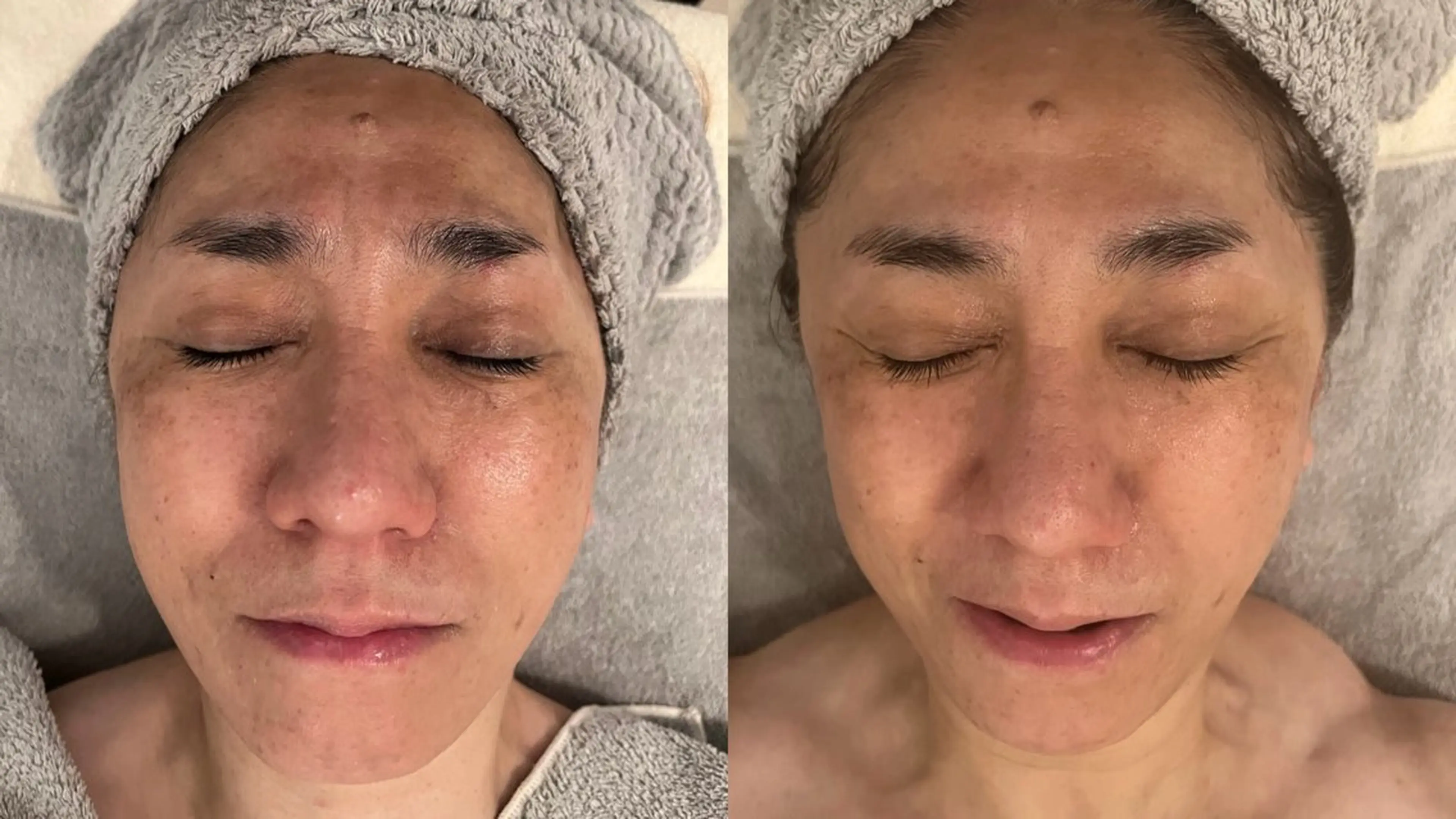 エステ リラク POLA アスティ45店のエステ・リラクイメージ