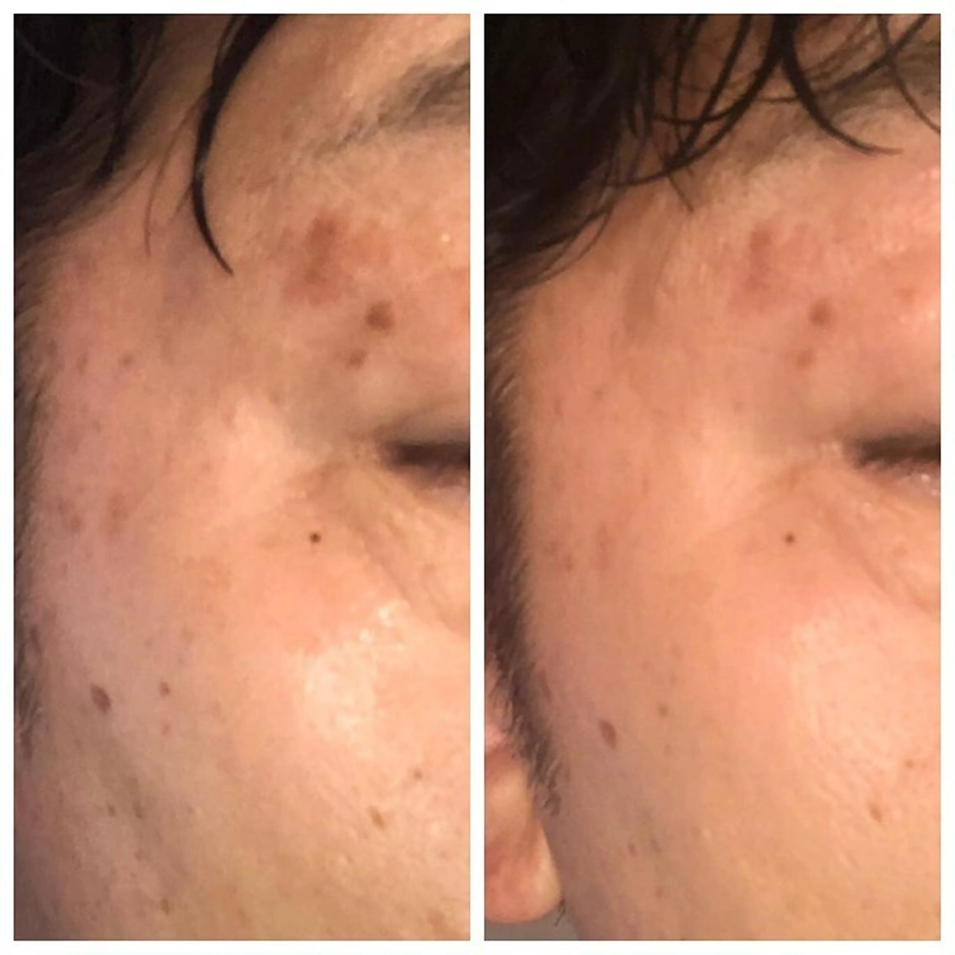 ドリームストリーム アイリストのエステ・リラクイメージ