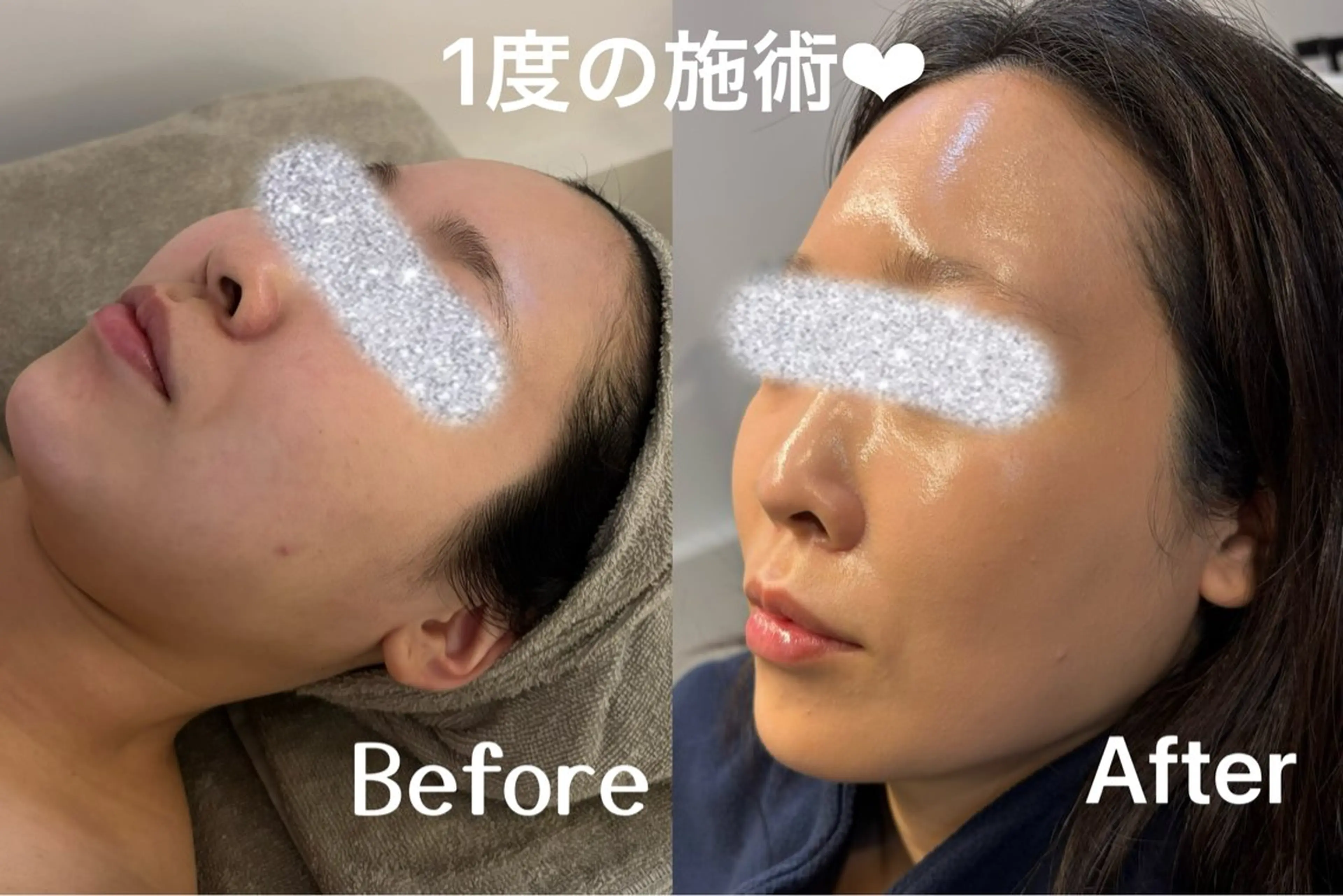 エステ リラク facial salon D 吉沢のエステ・リラクイメージ