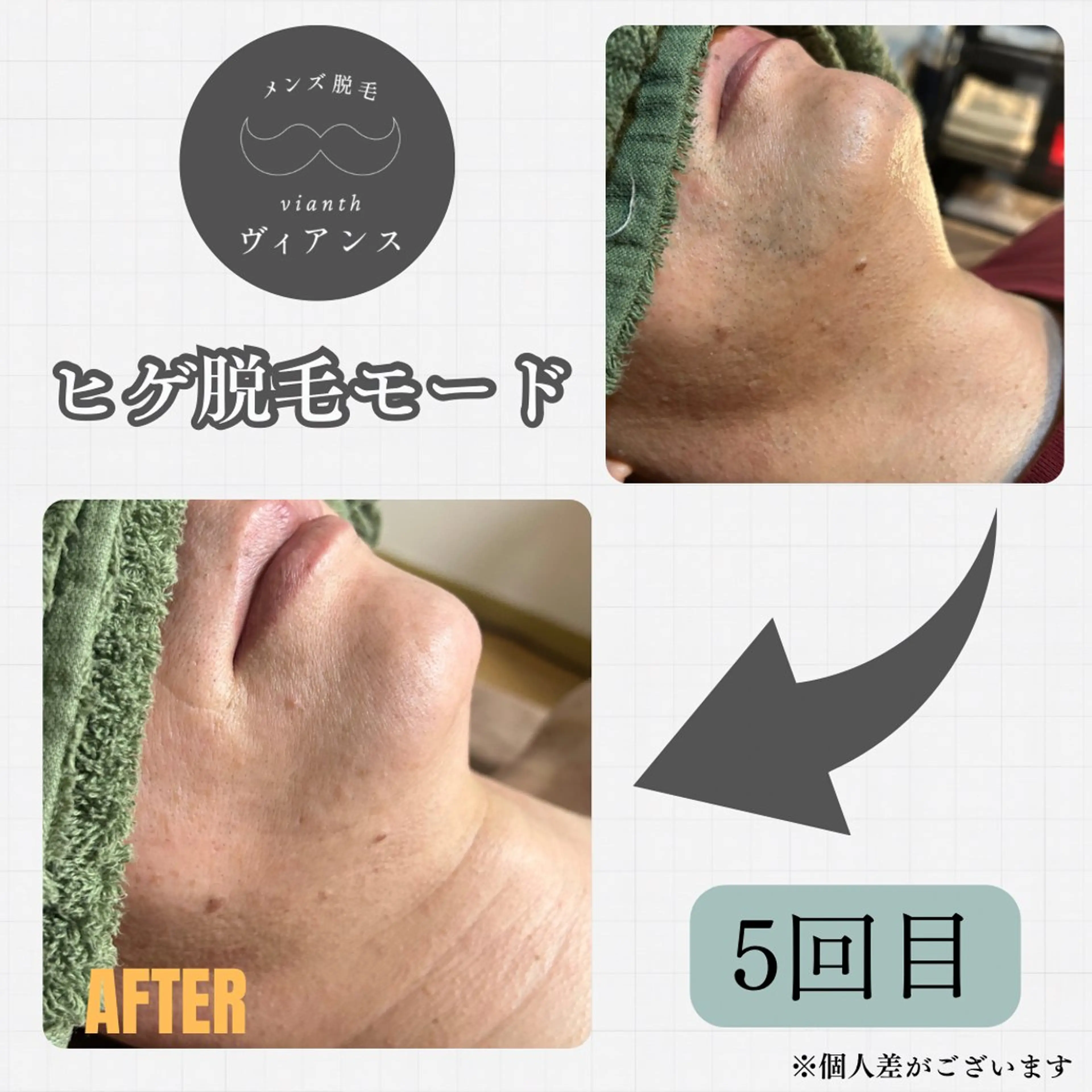 メンズ 脱毛 メンズ脱毛ヴィアンス fujitaのエステ・リラクイメージ