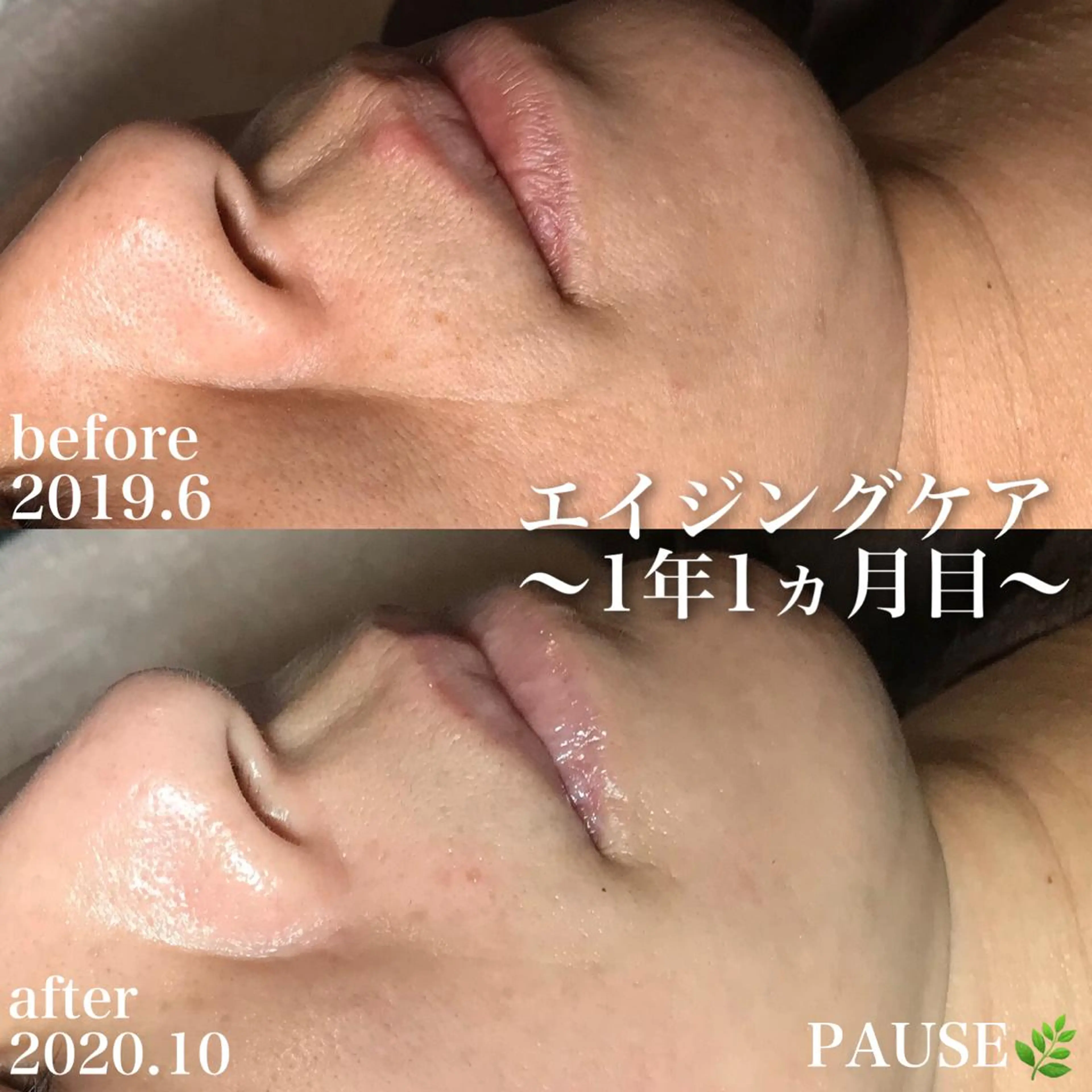 エステ 浜野 恵美のエステ・リラクイメージ