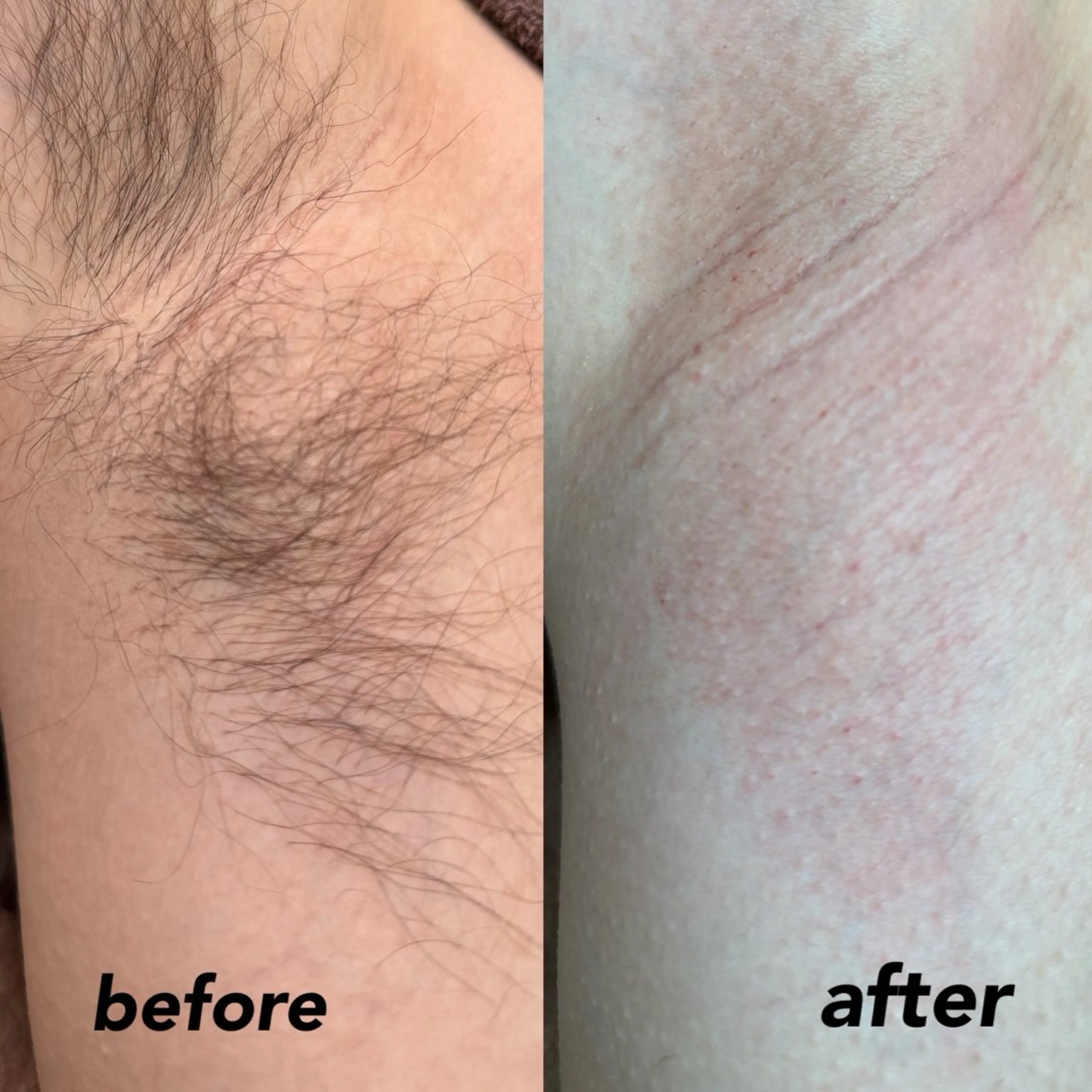 脱毛サロン CREVIOのエステ・リラクイメージ