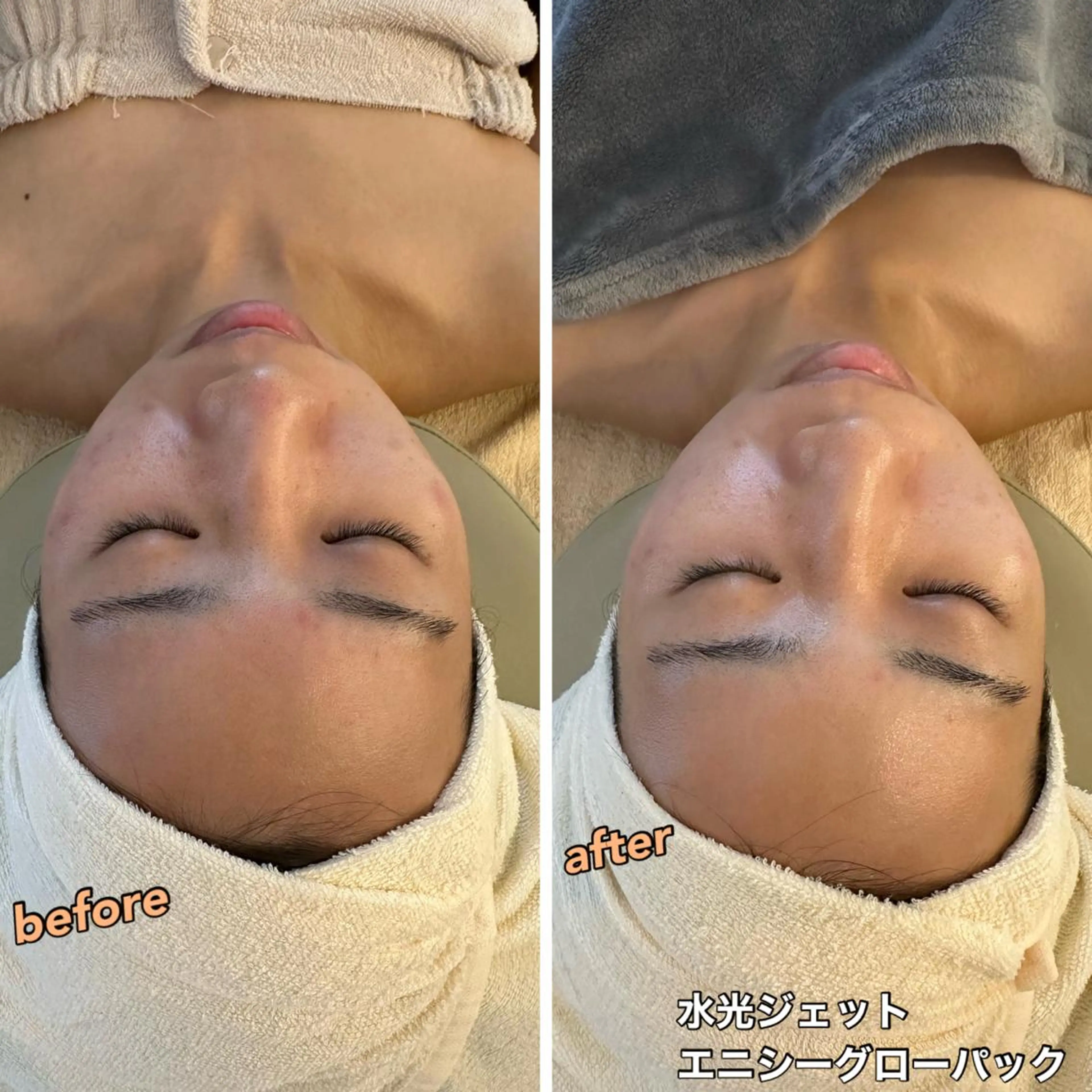 エステ うなじ脱毛/美肌脱毛 LABELのエステ・リラクイメージ