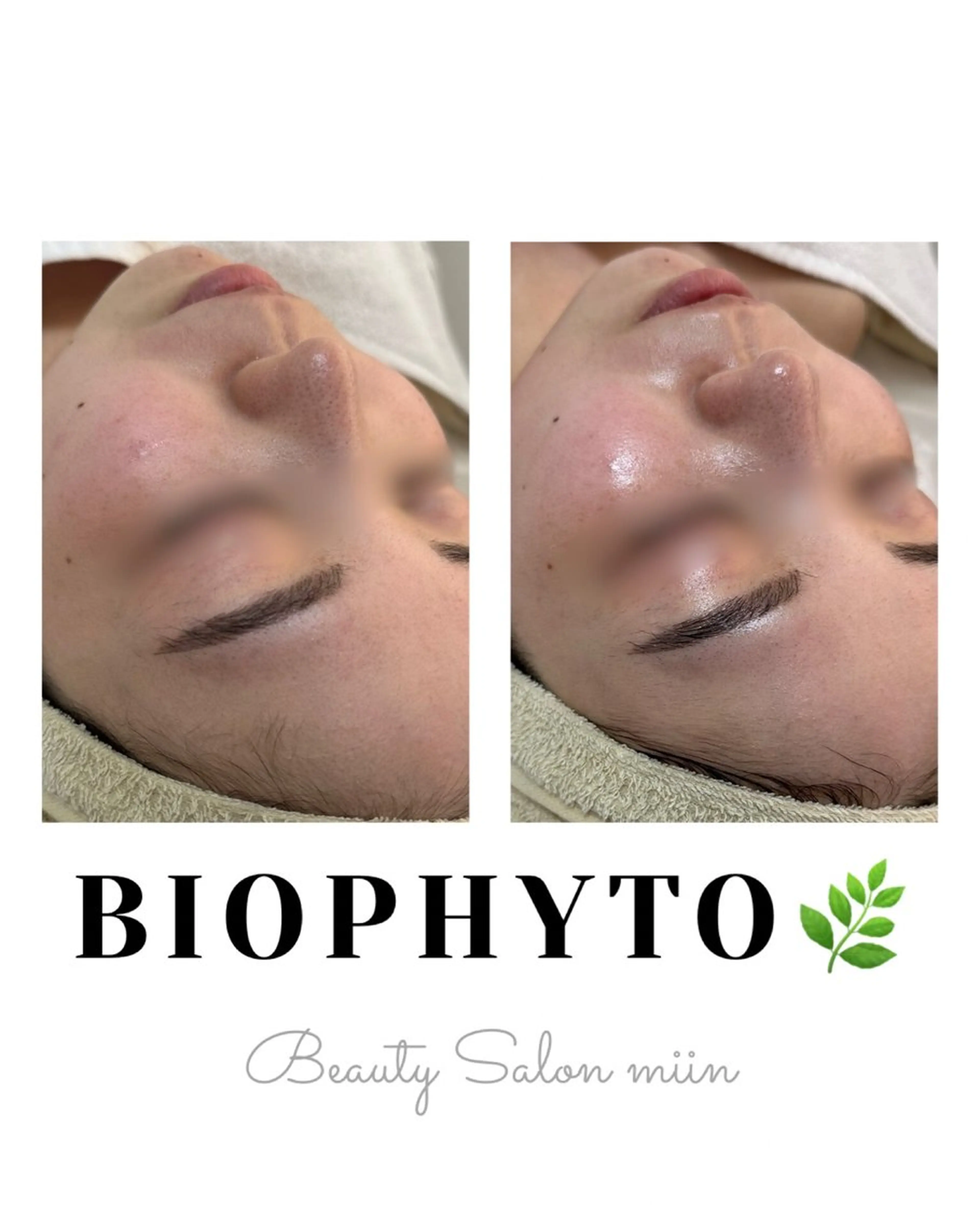 リラク 韓国肌管理 白玉肌管理®︎のエステ・リラクイメージ