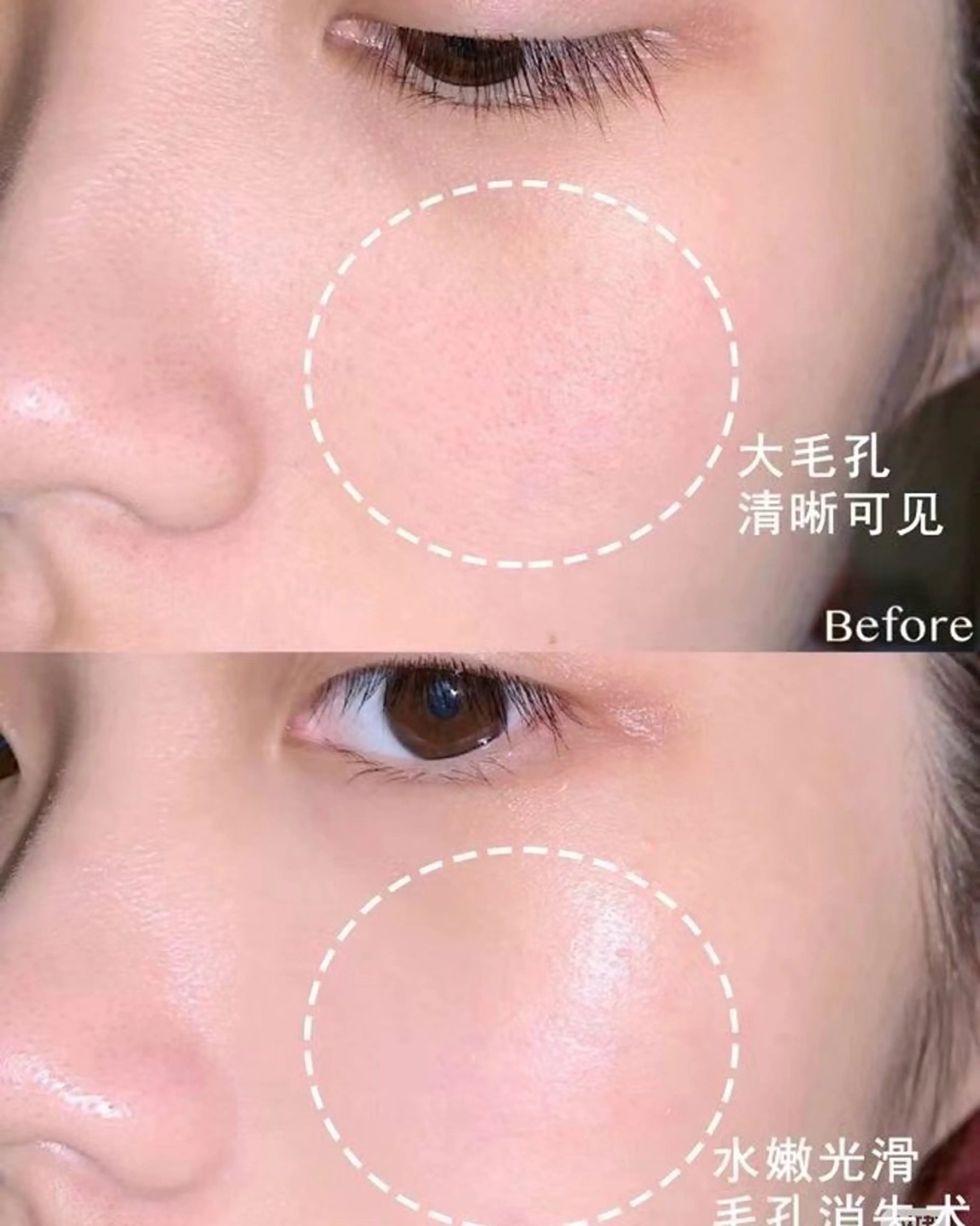 マツエク・マツパ エステ aliaハイフ&水光ジェットサロン所属・aliaハーブ水光店 エステティシャン募集のエステ・リラクイメージ