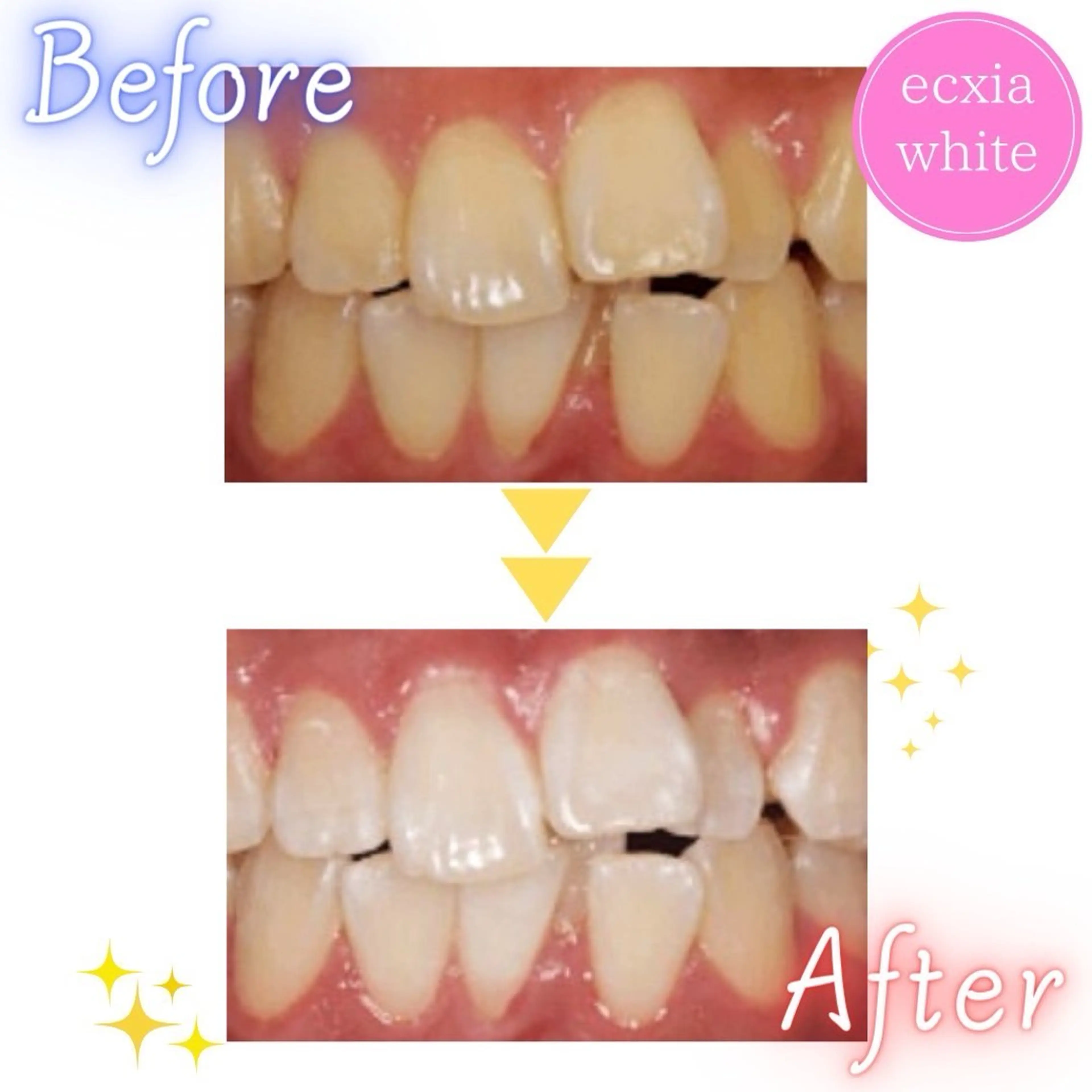 セルフホワイトニング エクシア仙台駅東口店のその他イメージ