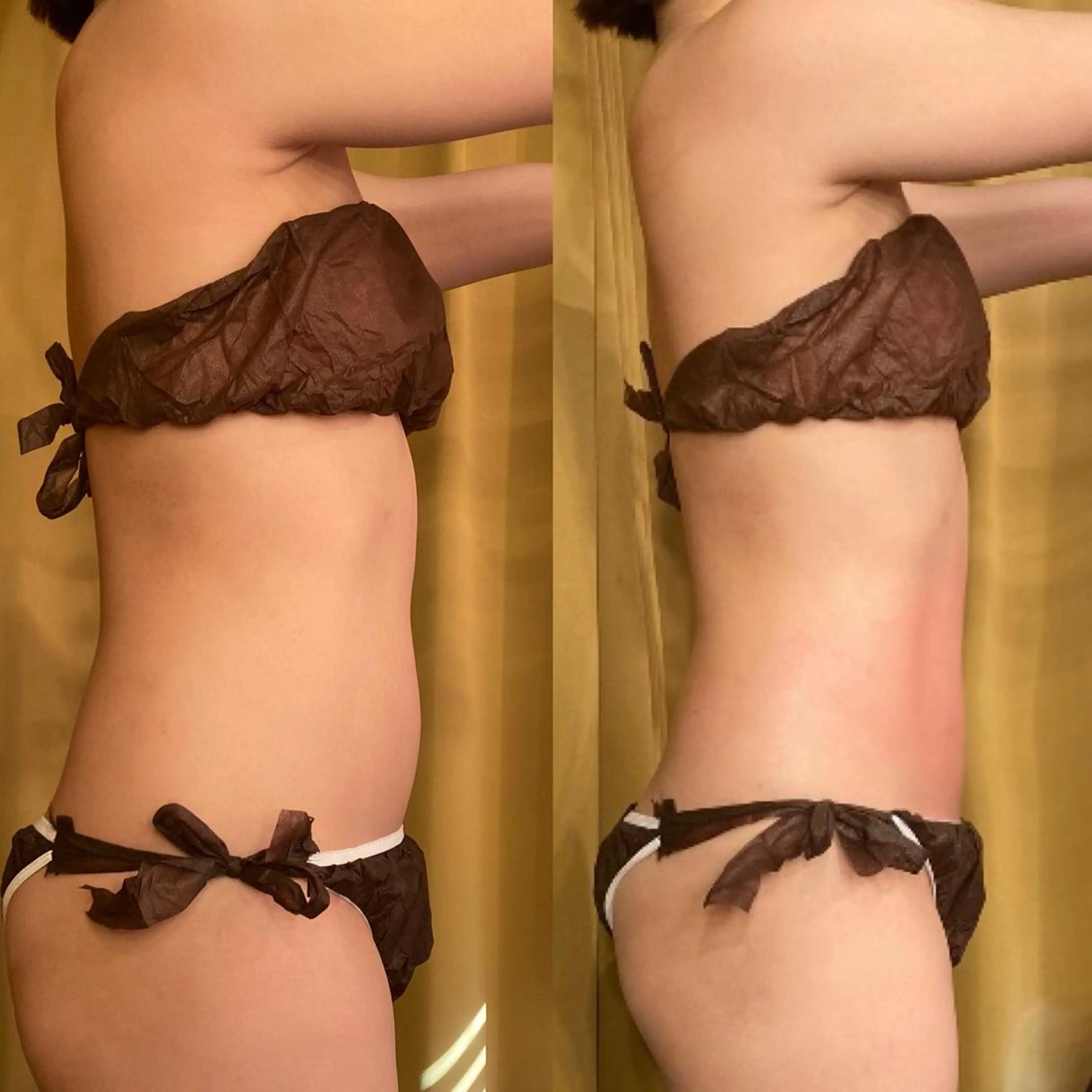 小顔やたるみに特化 💚野瀬可蓮のその他イメージ