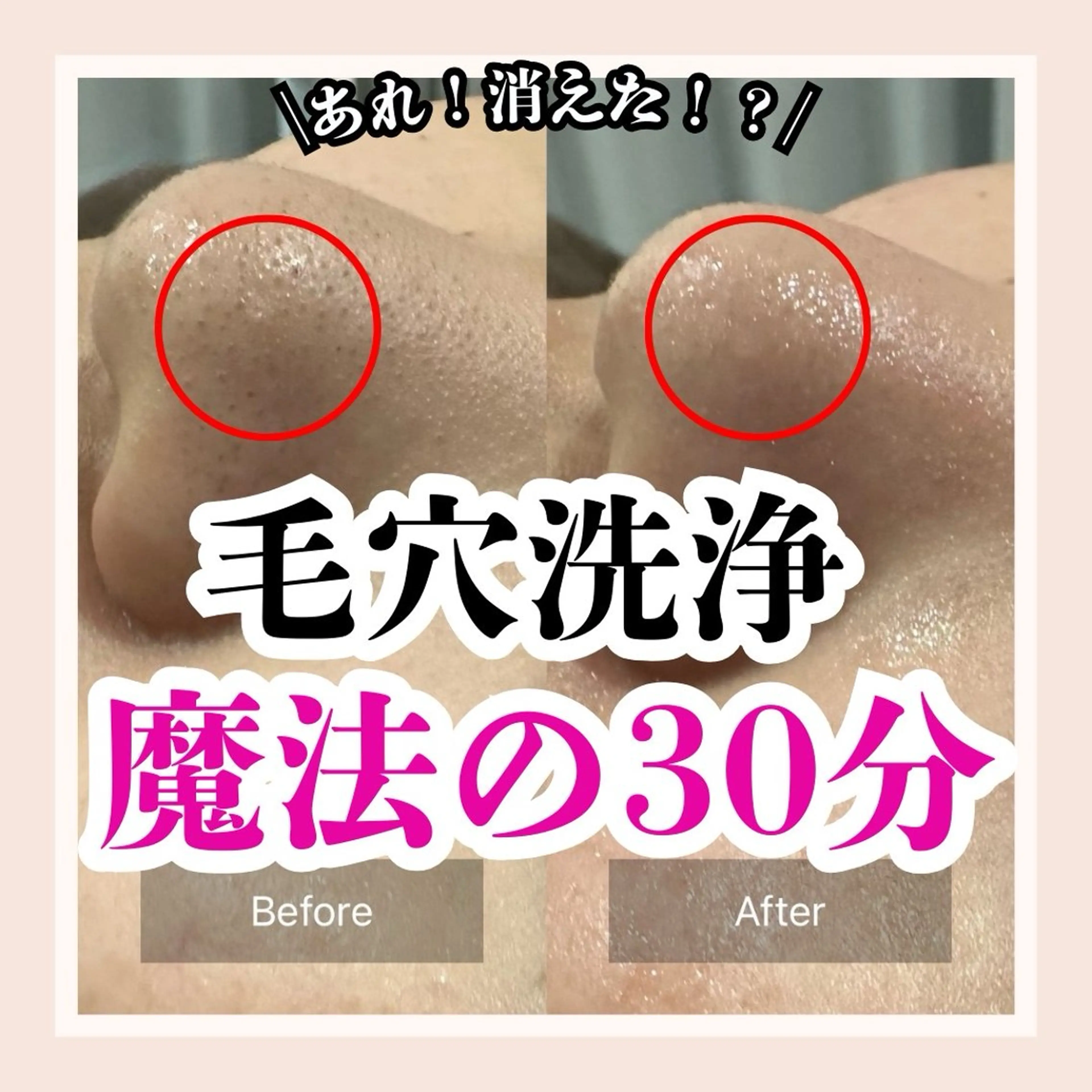 毛穴洗浄専門サロン/CareNa梅田【毛穴/ケアナ】所属・CareNa梅田店 🌿Mihoのエステ・リラクイメージ