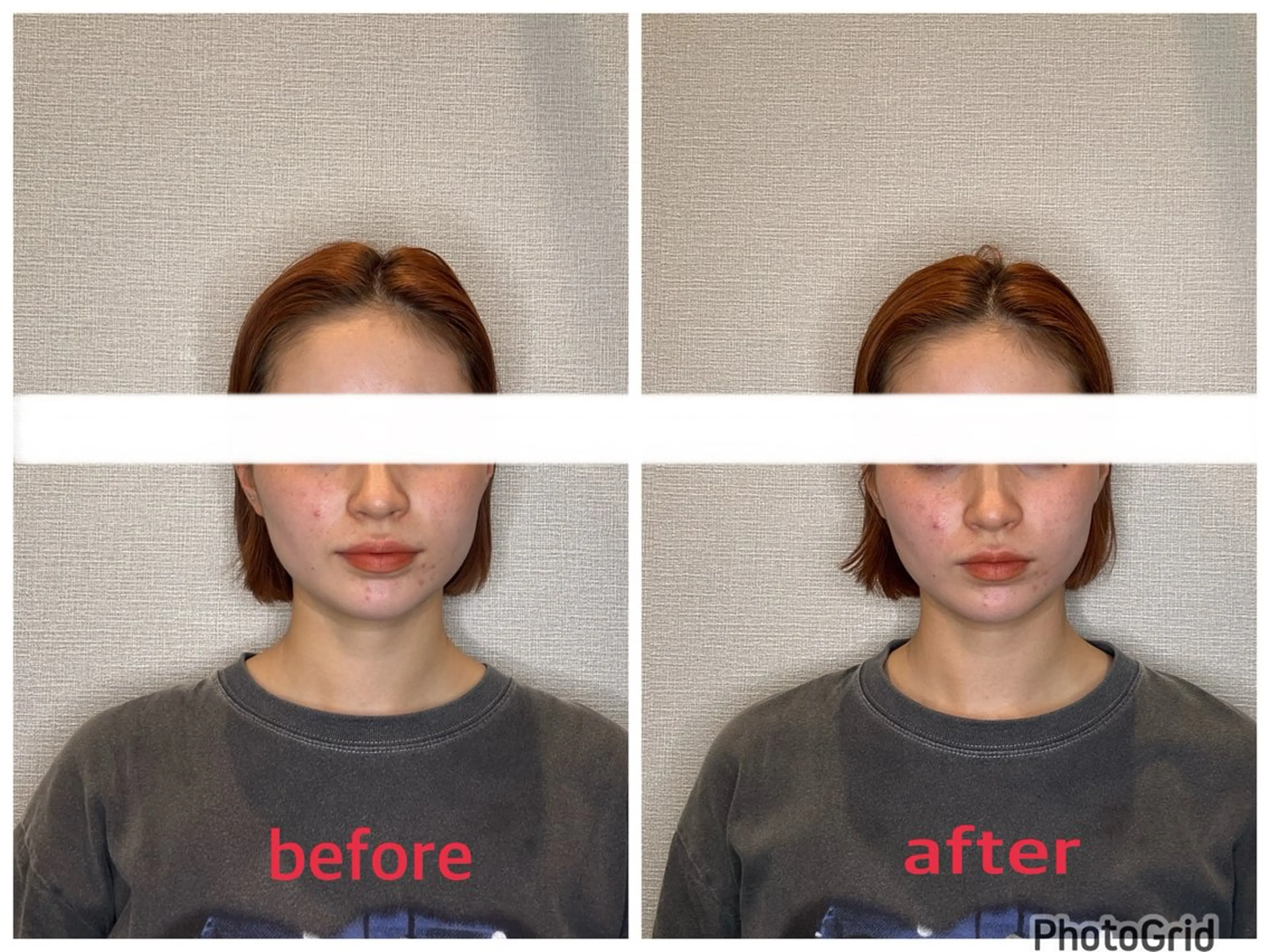 エステ リラク 小林整骨院本町 美容鍼roomのエステ・リラクイメージ