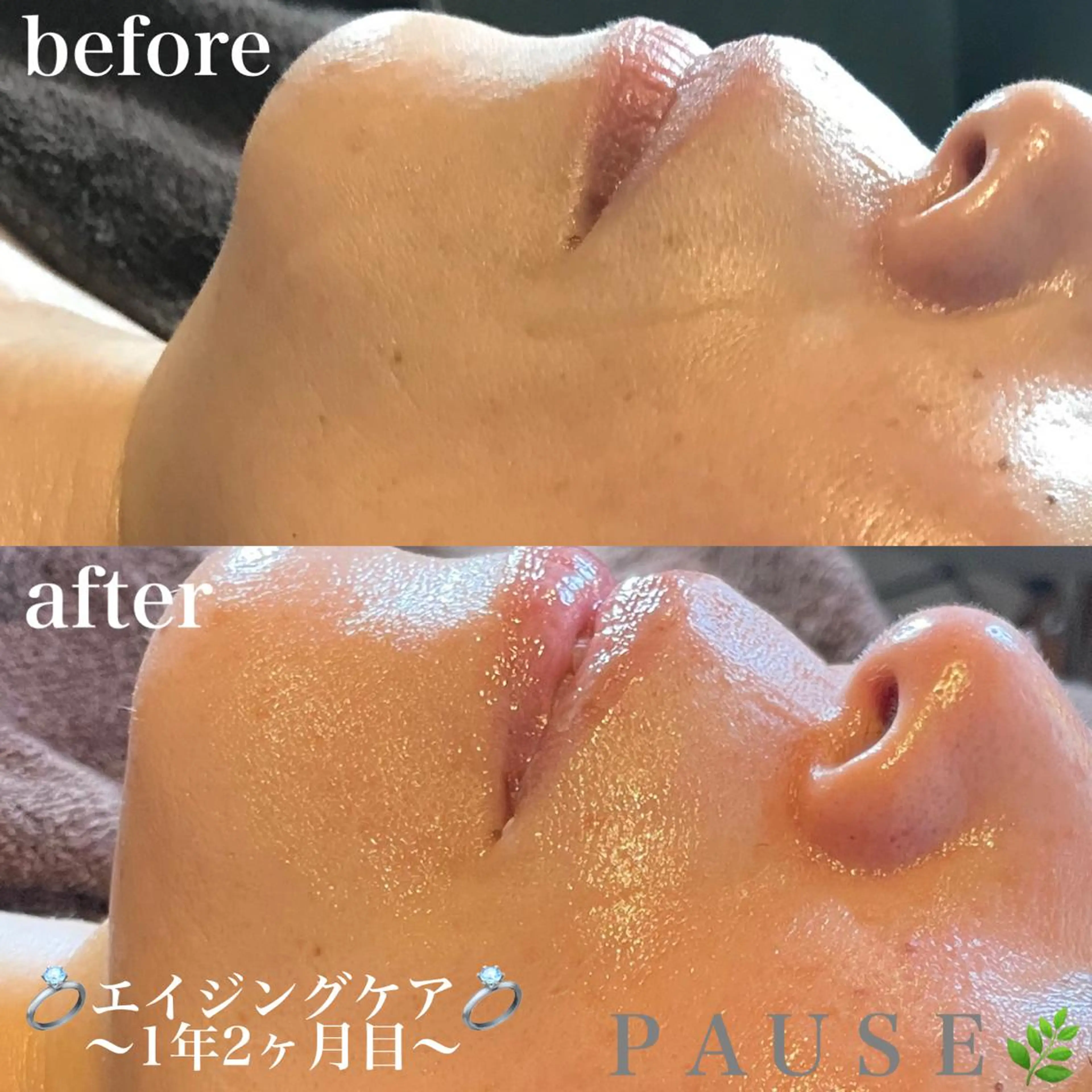 エステ 浜野 恵美のエステ・リラクイメージ