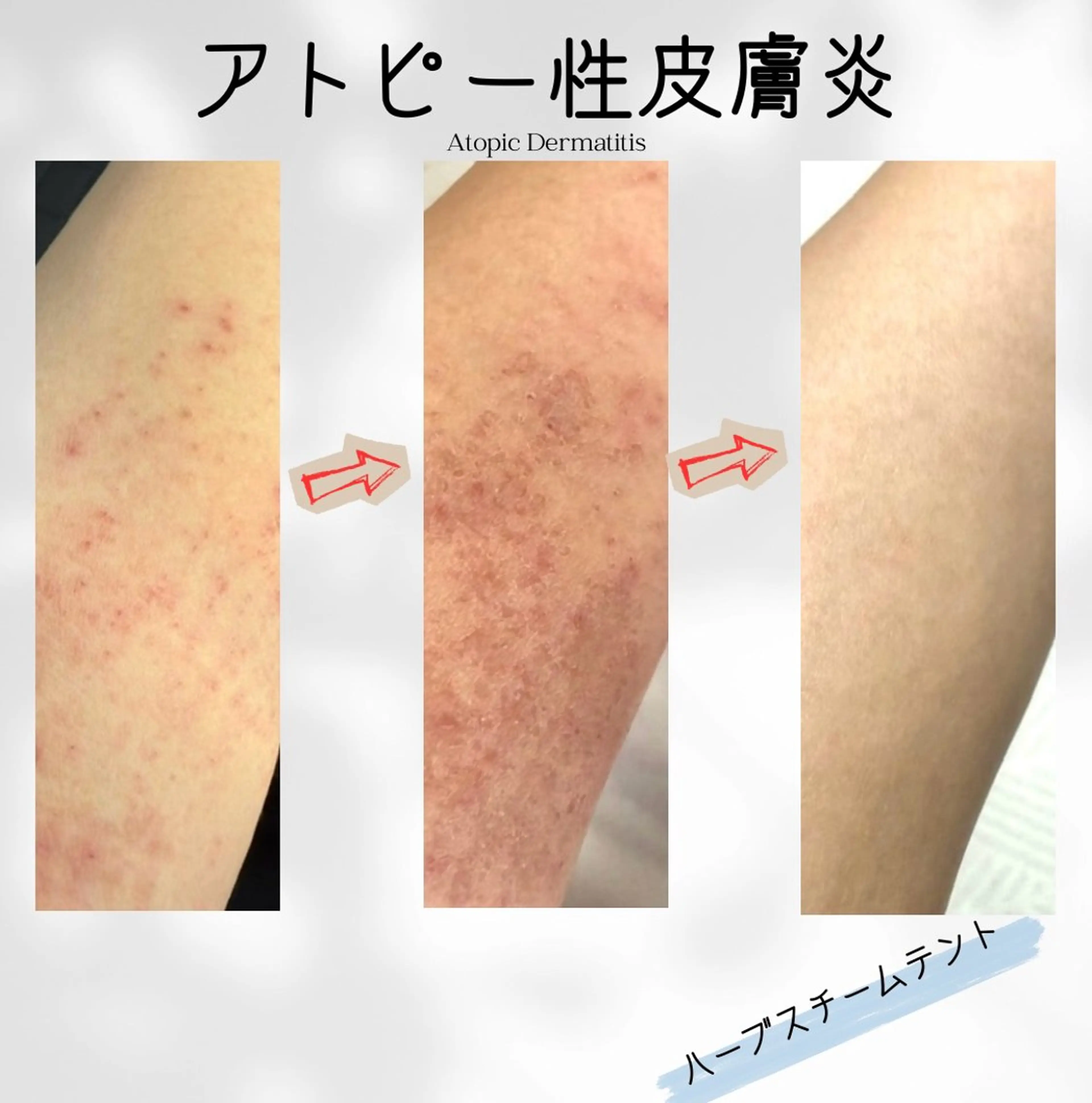 エステ リラク 体質改善✨美肌育サロ ン 香嬉琉🌿きよかのエステ・リラクイメージ